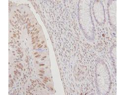 Immunohistochemistry: FANCJ Antibody [NB100-416] - Analysis of FANCJ in human colon and rectum tissues. Image courtesy of an anonymous customer review.