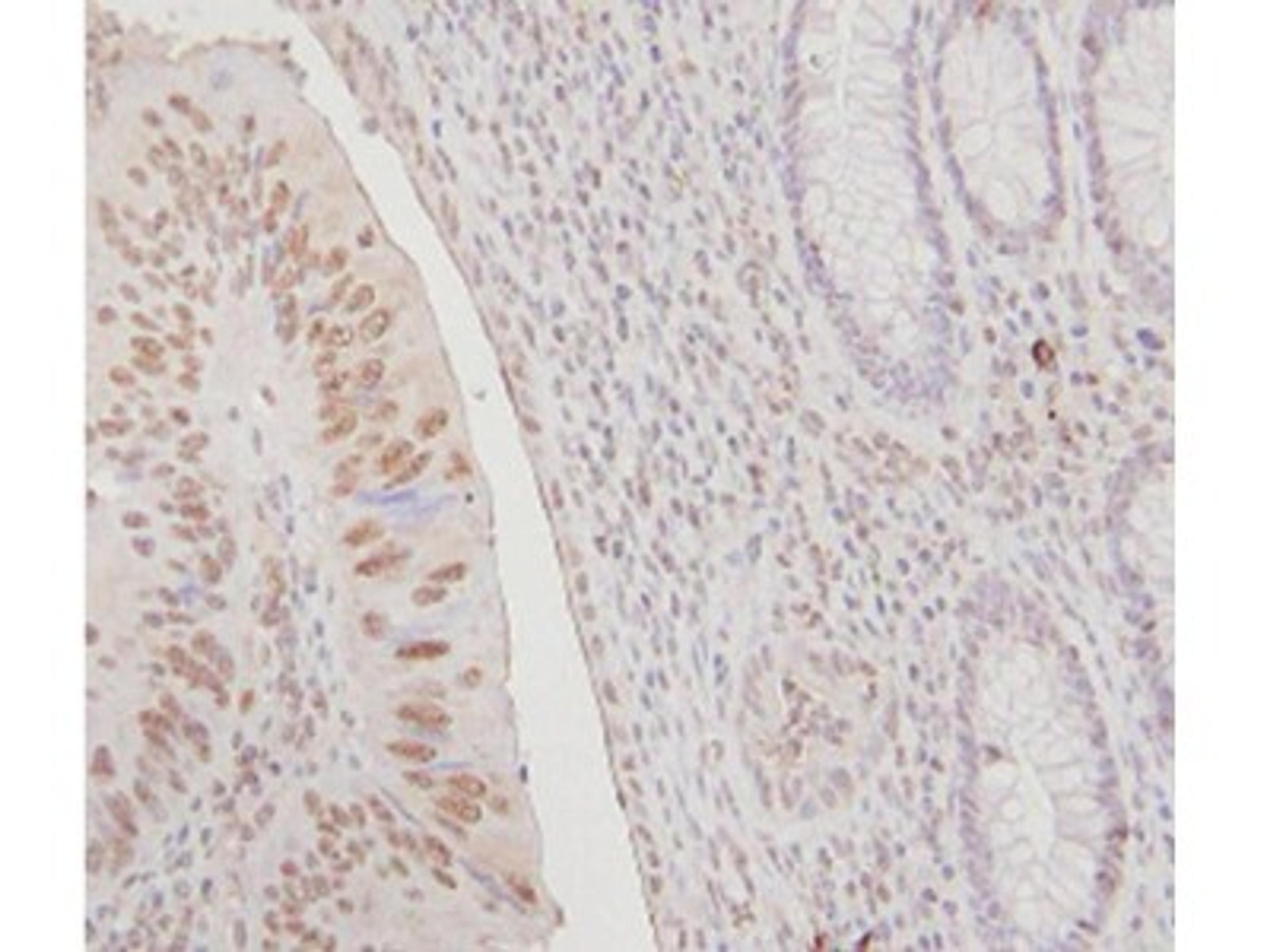 Immunohistochemistry: FANCJ Antibody [NB100-416] - Analysis of FANCJ in human colon and rectum tissues. Image courtesy of an anonymous customer review.