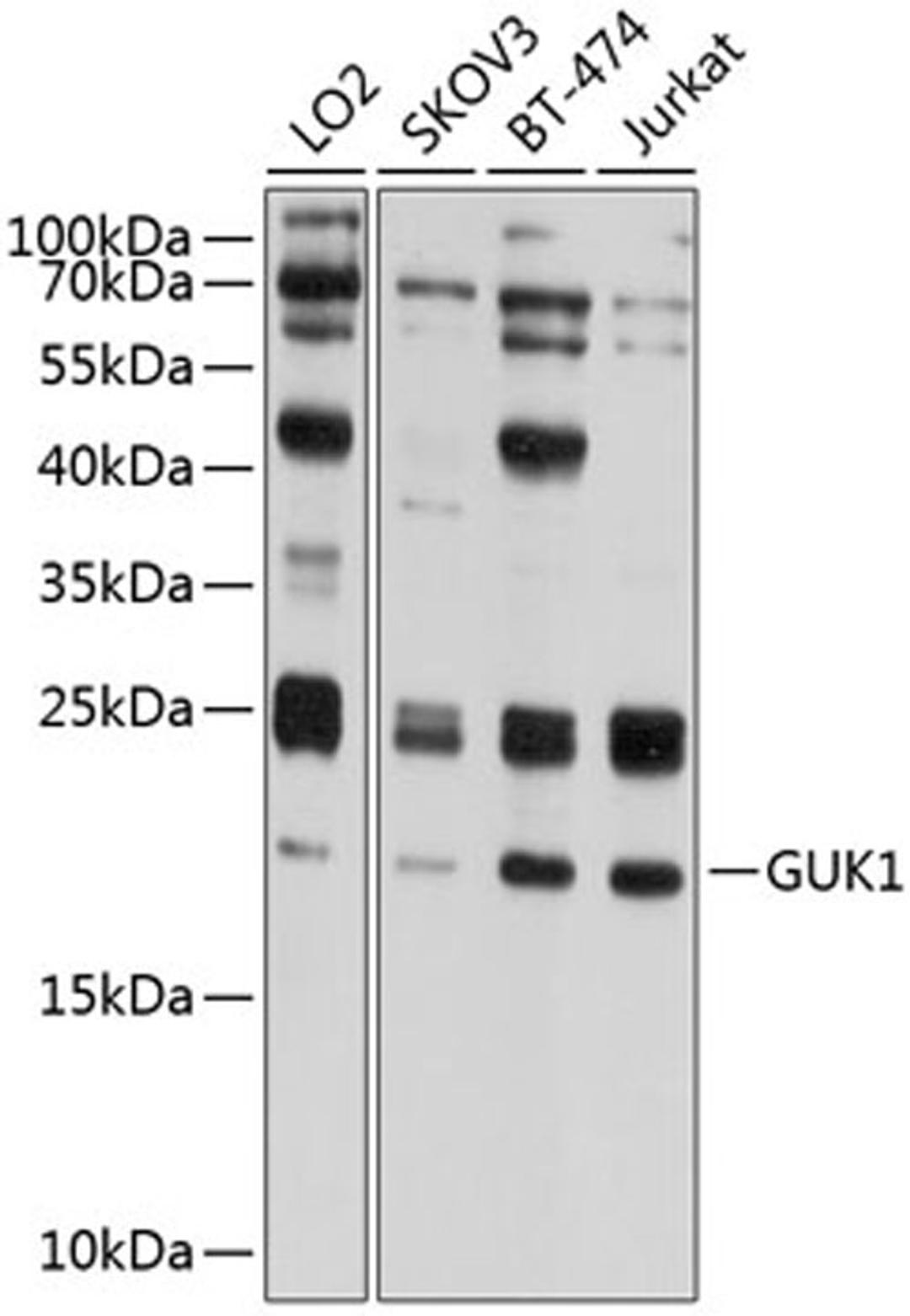 Western blot - GUK1 antibody (A8656)