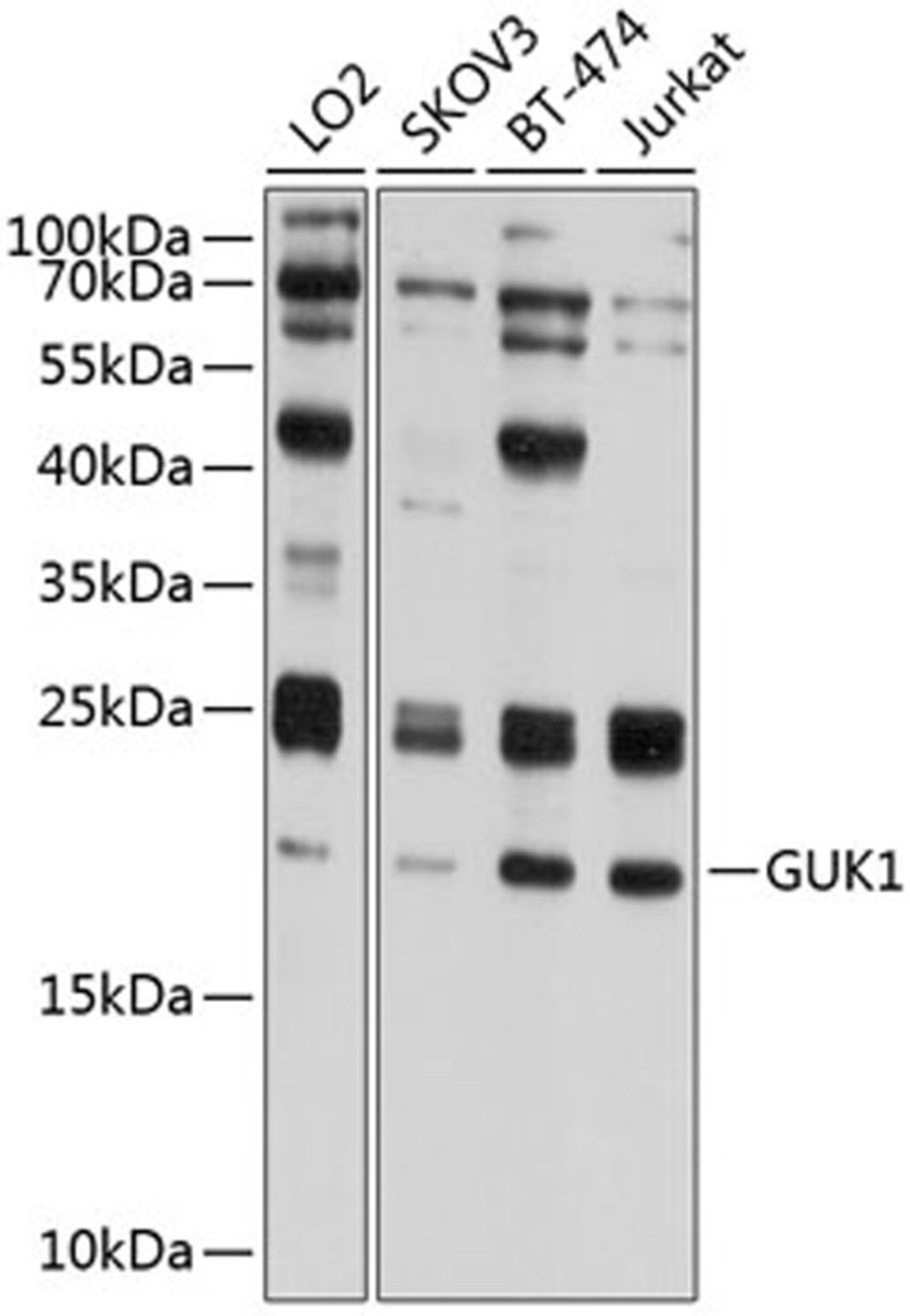 Western blot - GUK1 antibody (A8656)