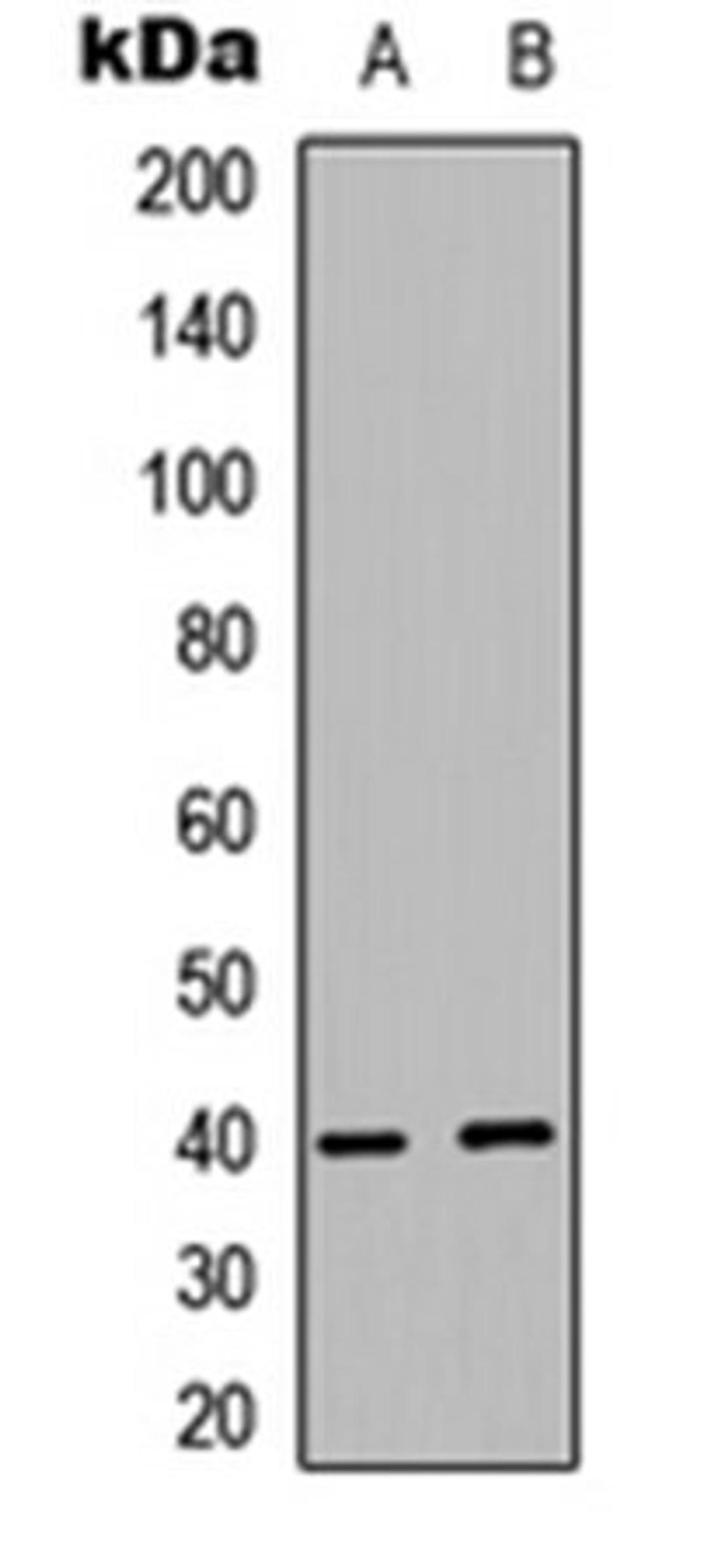 Western blot analysis of MCF7 (Lane 1), human Testis (Lane 2) whole cell lysates using PRAS40 antibody