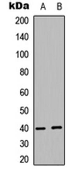 Western blot analysis of MCF7 (Lane 1), human Testis (Lane 2) whole cell lysates using PRAS40 antibody