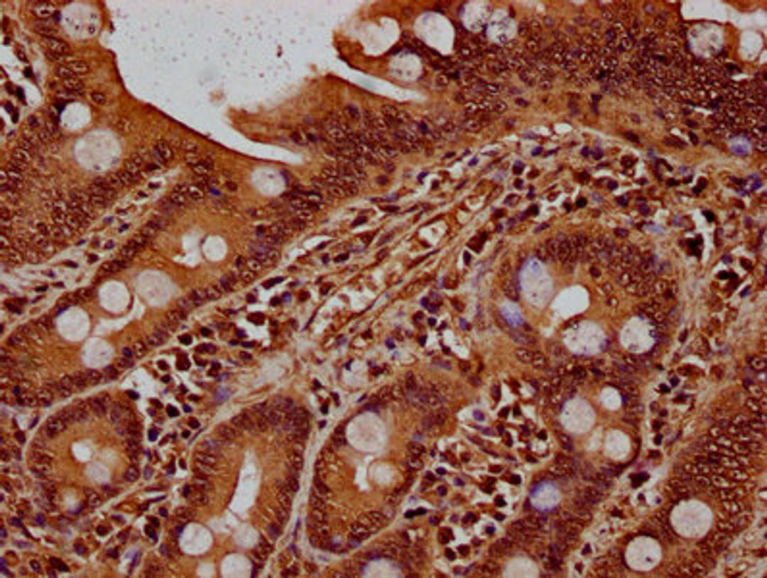 IHC image of CSB-PA010379OA90nbhbHU diluted at 1:20 and staining in paraffin-embedded human small intestine tissue performed on a Leica BondTM system. After dewaxing and hydration, antigen retrieval was mediated by high pressure in a citrate buffer (pH 6.0). Section was blocked with 10% normal goat serum 30min at RT. Then primary antibody (1% BSA) was incubated at 4°C overnight. The primary is detected by a biotinylated secondary antibody and visualized using an HRP conjugated SP system.