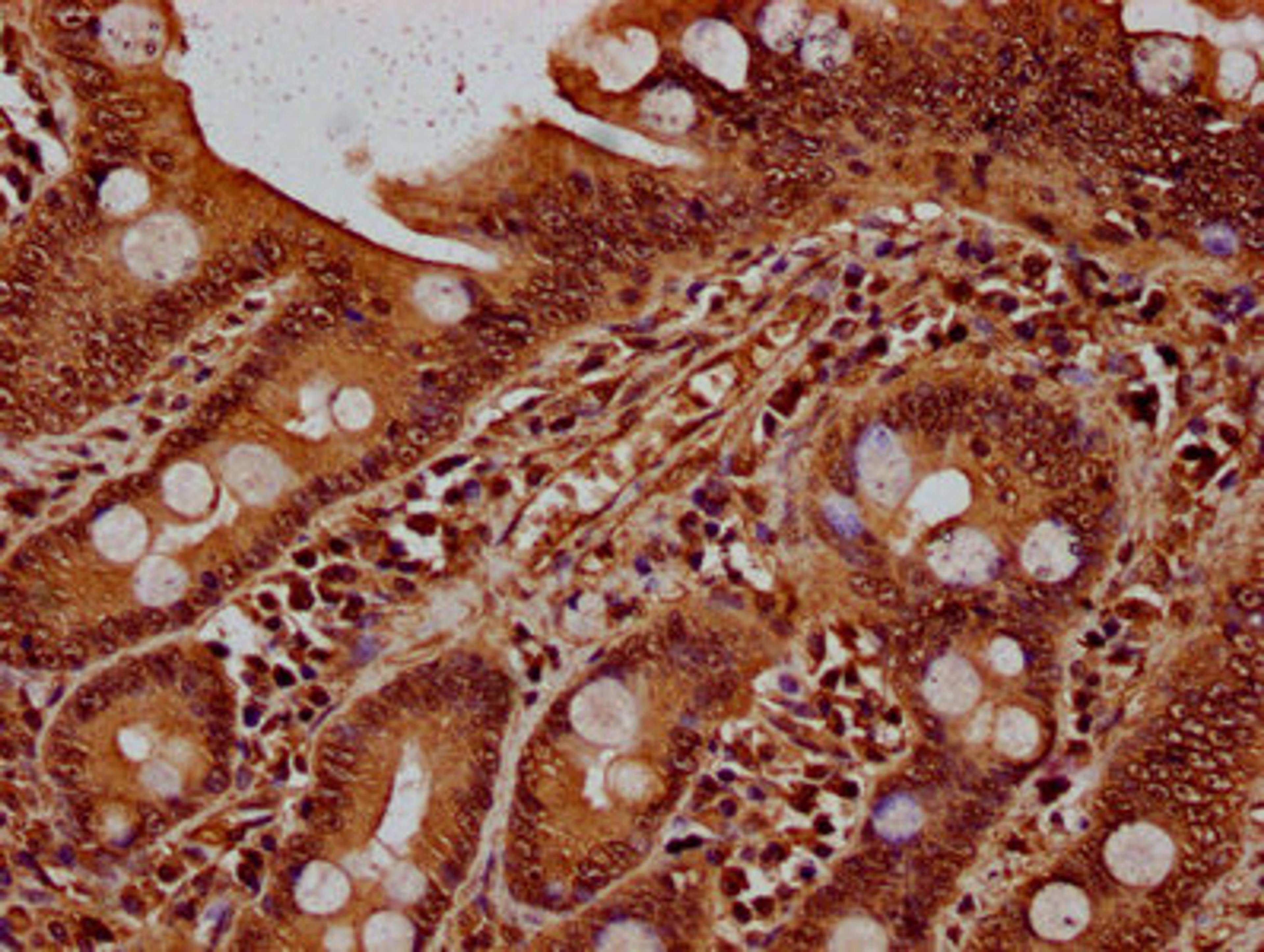 IHC image of CSB-PA010379OA90nbhbHU diluted at 1:20 and staining in paraffin-embedded human small intestine tissue performed on a Leica BondTM system. After dewaxing and hydration, antigen retrieval was mediated by high pressure in a citrate buffer (pH 6.0). Section was blocked with 10% normal goat serum 30min at RT. Then primary antibody (1% BSA) was incubated at 4°C overnight. The primary is detected by a biotinylated secondary antibody and visualized using an HRP conjugated SP system.