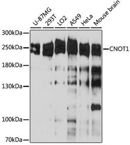 Western blot - CNOT1 antibody (A5969)