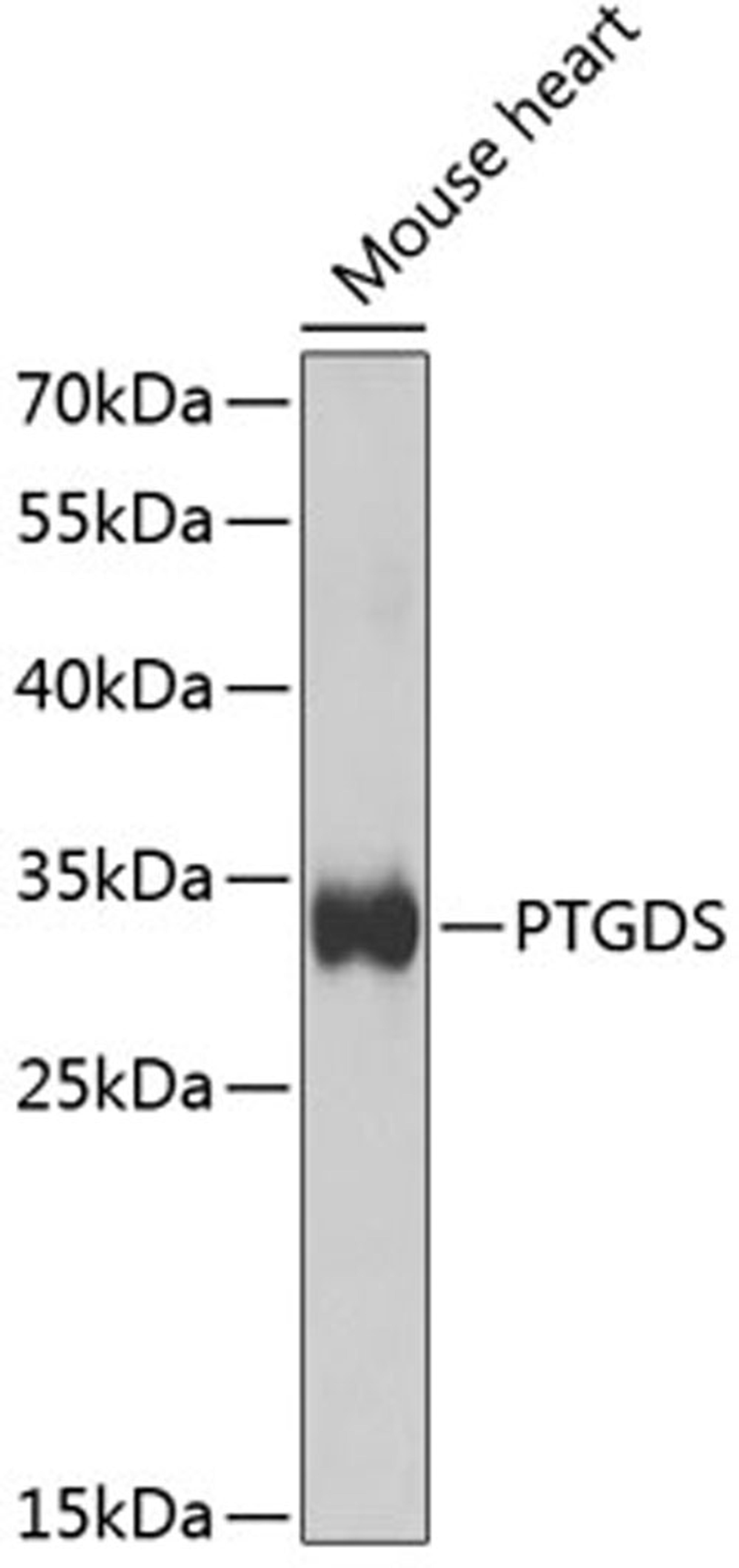 Western blot - PTGDS antibody (A1889)