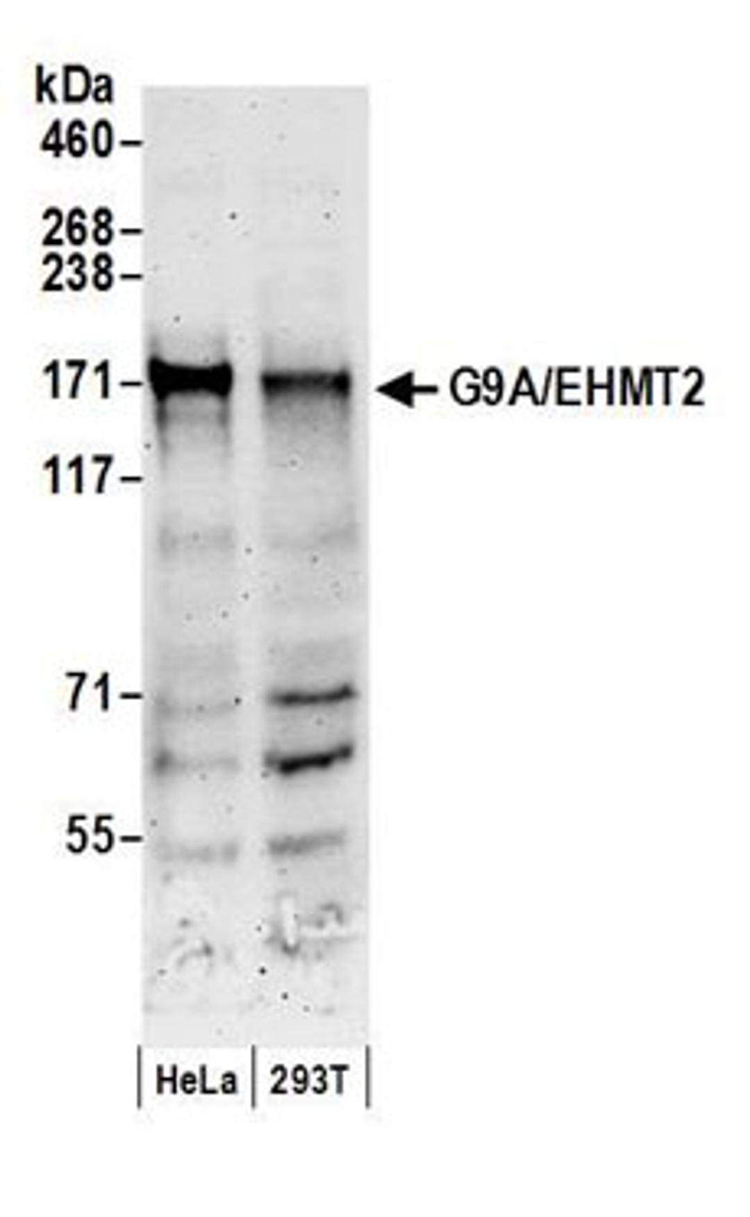 Detection of human G9A/EHMT2 by western blot.