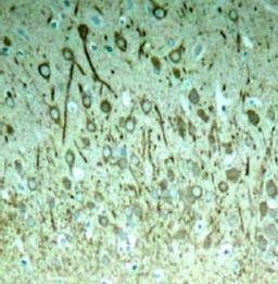 Immunohistochemistry: Tau [p Thr231] Antibody [NB100-82249] - Immunohistochemical analysis of paraffin-embedded rat hippocampal region tissue from a model with Alzheimer's Disease using Tau (phospho-Thr231) antibody.