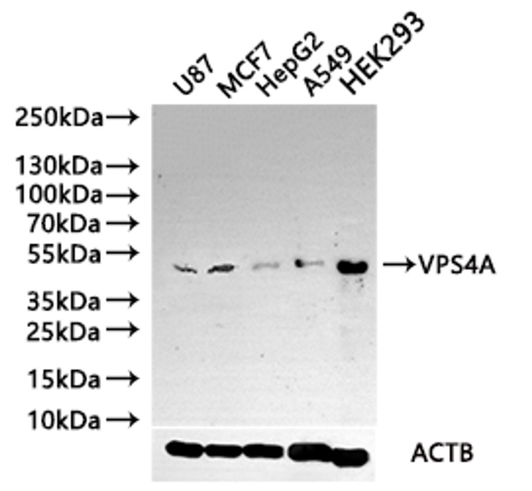 Western blot. All lanes: VPS4Aantibody at 4.28ug/ml. Lane 1: Mouse kidney tissue. Lane 2: Rat gonadal tissue. Lane 3: Mouse brain tissue. Lane 4: U87 whole cell lysate. Lane 5: MCF-7 whole cell lysate. Secondary. Goat polyclonal to rabbit IgG at 1/10000 dilution. Predicted band size: 49 kDa. Observed band size: 49 kDa.