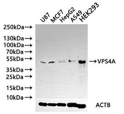 Western blot. All lanes: VPS4Aantibody at 4.28ug/ml. Lane 1: Mouse kidney tissue. Lane 2: Rat gonadal tissue. Lane 3: Mouse brain tissue. Lane 4: U87 whole cell lysate. Lane 5: MCF-7 whole cell lysate. Secondary. Goat polyclonal to rabbit IgG at 1/10000 dilution. Predicted band size: 49 kDa. Observed band size: 49 kDa.