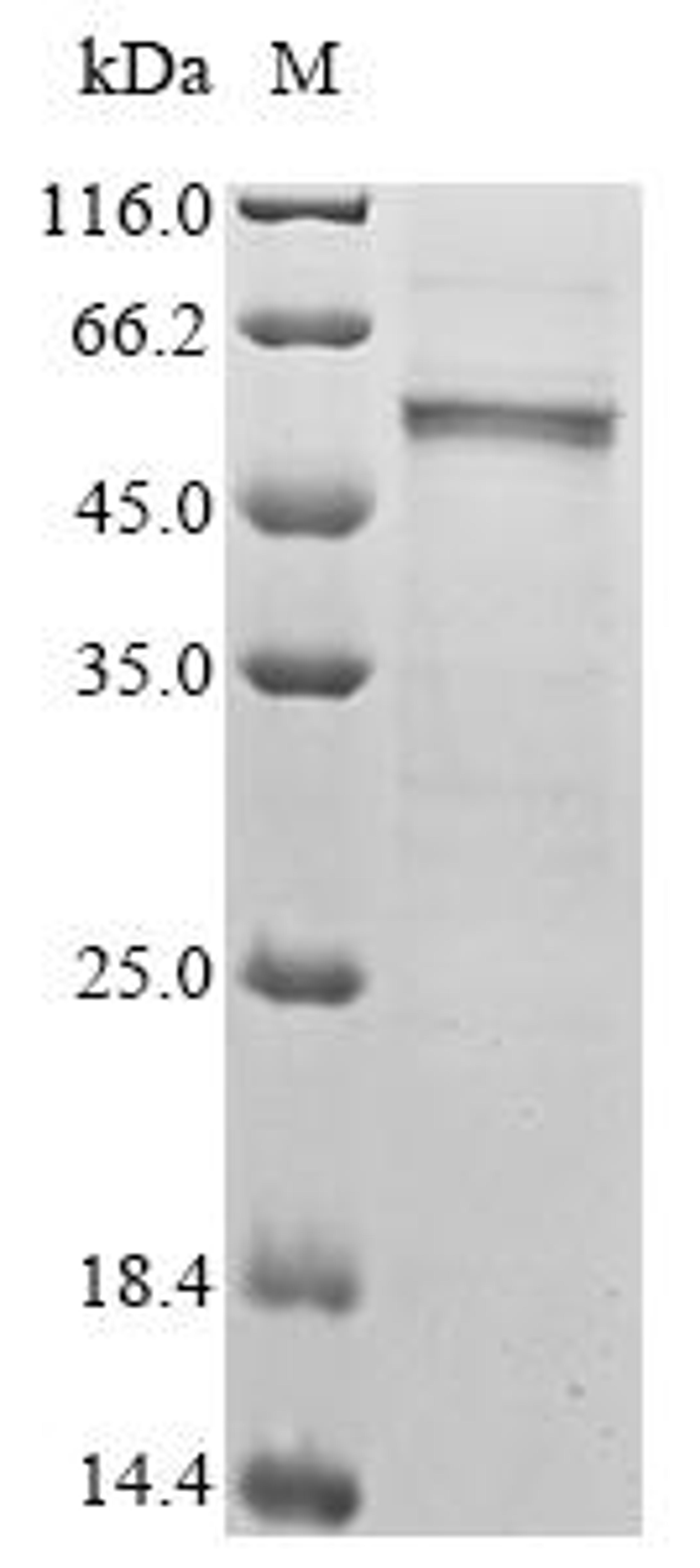 (Tris-Glycine gel) Discontinuous SDS-PAGE (reduced) with 5% enrichment gel and 15% separation gel.
