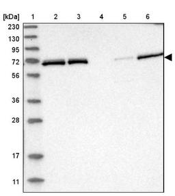 Western Blot: NPLOC4 Antibody [NBP1-82166] - Lane 1: Marker [kDa] 230, 130, 95, 72, 56, 36, 28, 17, 11<br/>Lane 2: Human cell line RT-4<br/>Lane 3: Human cell line U-251MG sp<br/>Lane 4: Human plasma (IgG/HSA depleted)<br/>Lane 5: Human liver tissue<br/>Lane 6: Human tonsil tissue