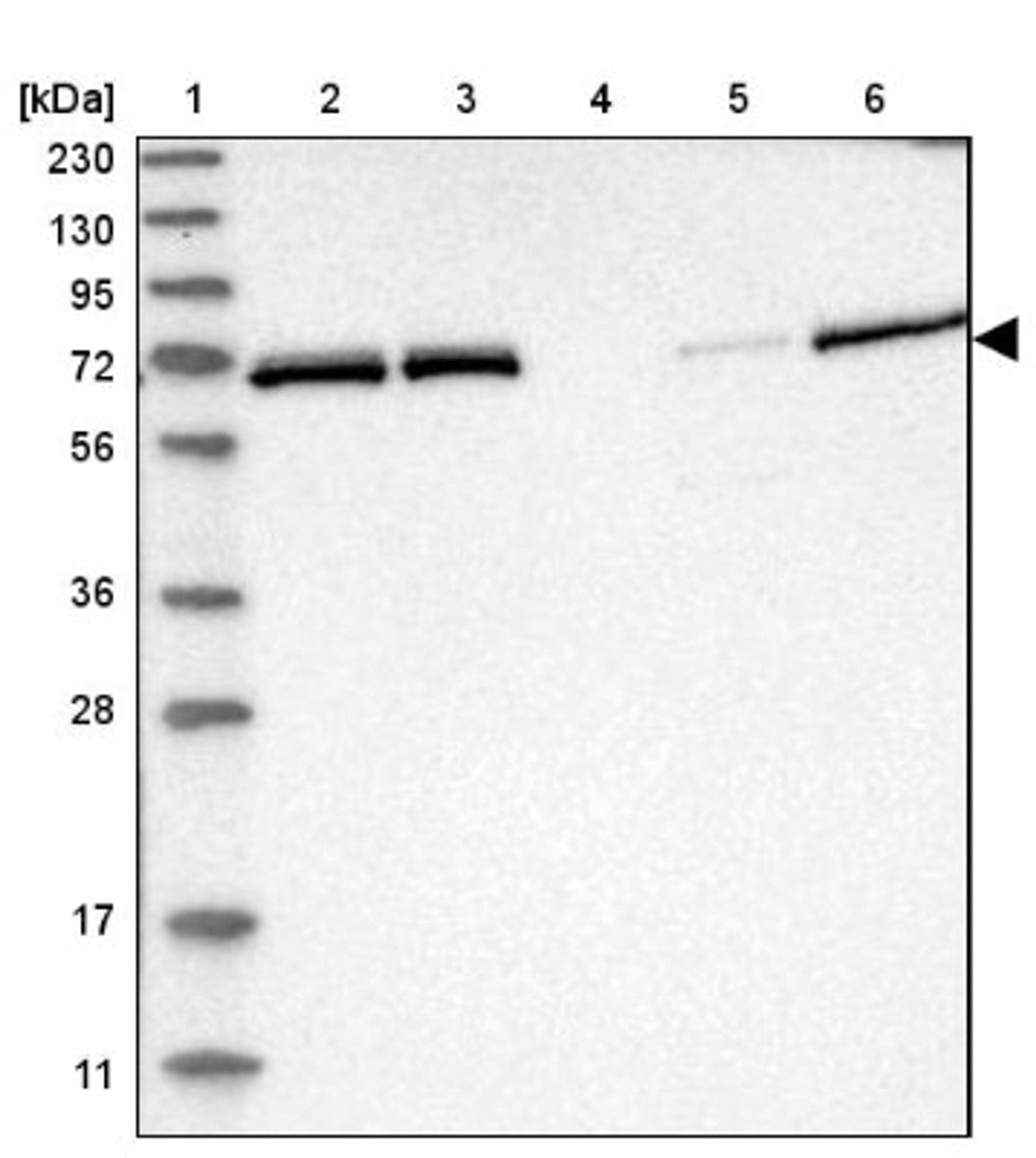 Western Blot: NPLOC4 Antibody [NBP1-82166] - Lane 1: Marker [kDa] 230, 130, 95, 72, 56, 36, 28, 17, 11<br/>Lane 2: Human cell line RT-4<br/>Lane 3: Human cell line U-251MG sp<br/>Lane 4: Human plasma (IgG/HSA depleted)<br/>Lane 5: Human liver tissue<br/>Lane 6: Human tonsil tissue