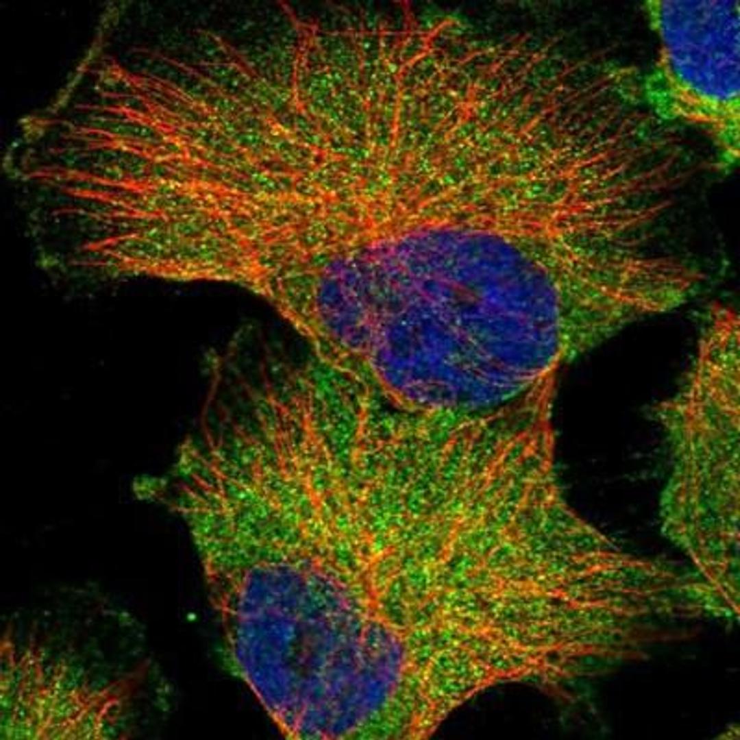 Immunocytochemistry/Immunofluorescence: GPR142 Antibody [NBP1-87286] - Staining of human cell line U-251MG shows positivity in plasma membrane & cytoplasm.