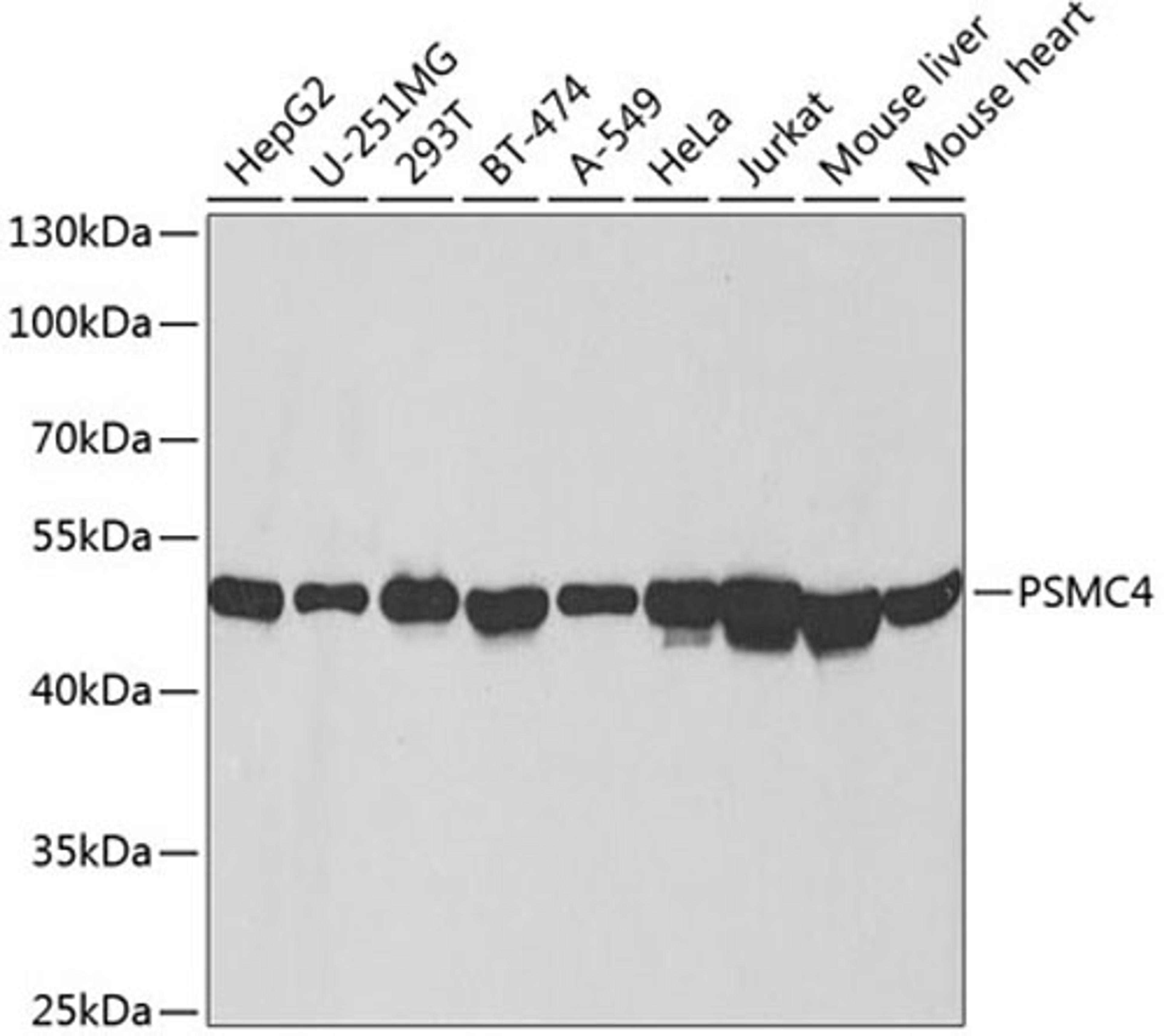 Western blot - PSMC4 antibody (A2505)