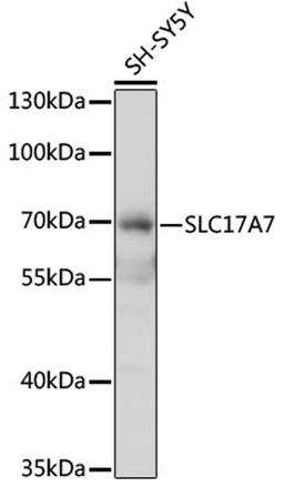 Western blot - SLC17A7 antibody (A12879)