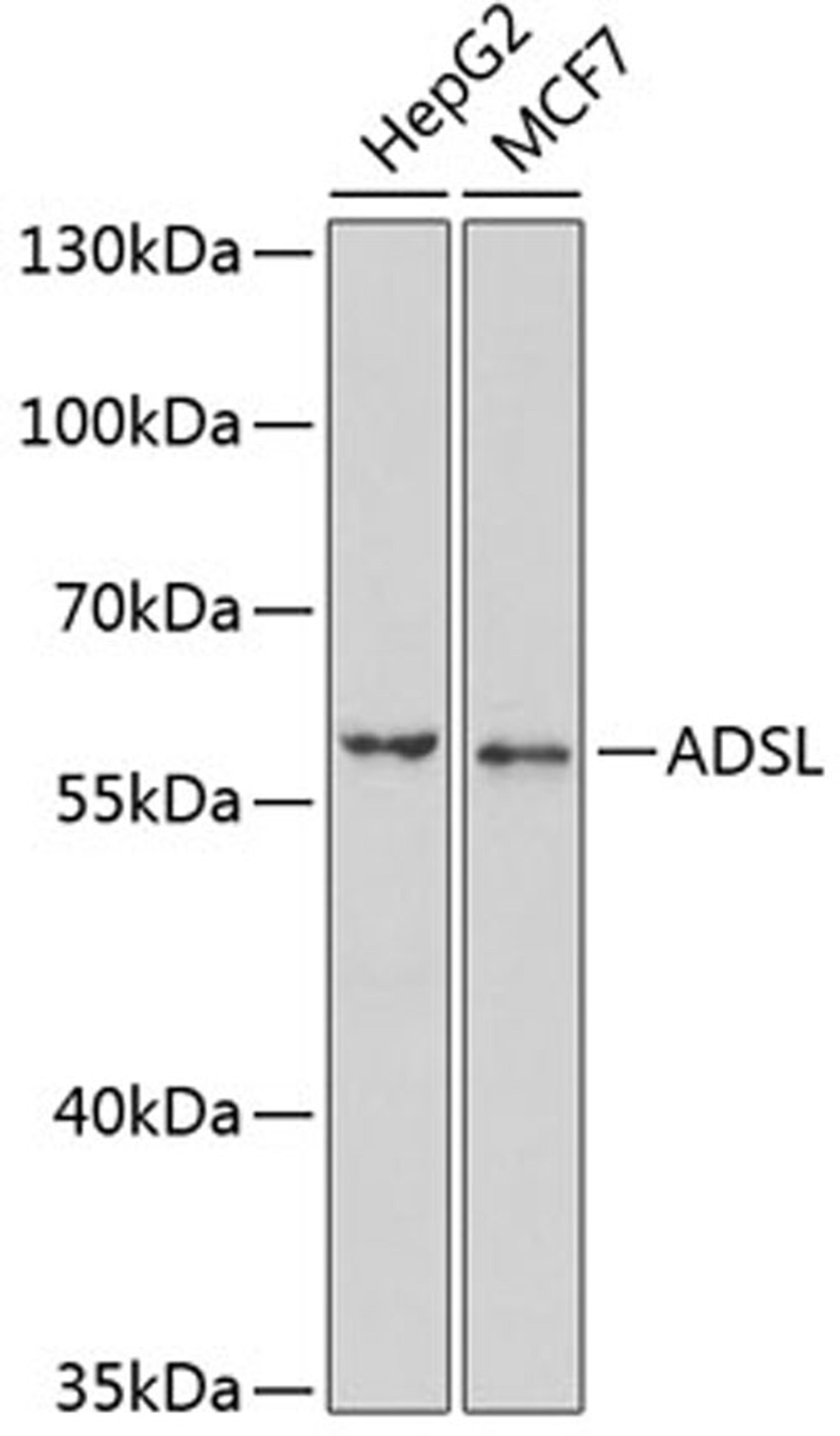 Western blot - ADSL antibody (A6278)