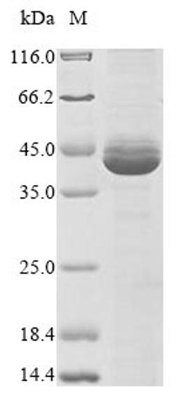 (Tris-Glycine gel) Discontinuous SDS-PAGE (reduced) with 5% enrichment gel and 15% separation gel.