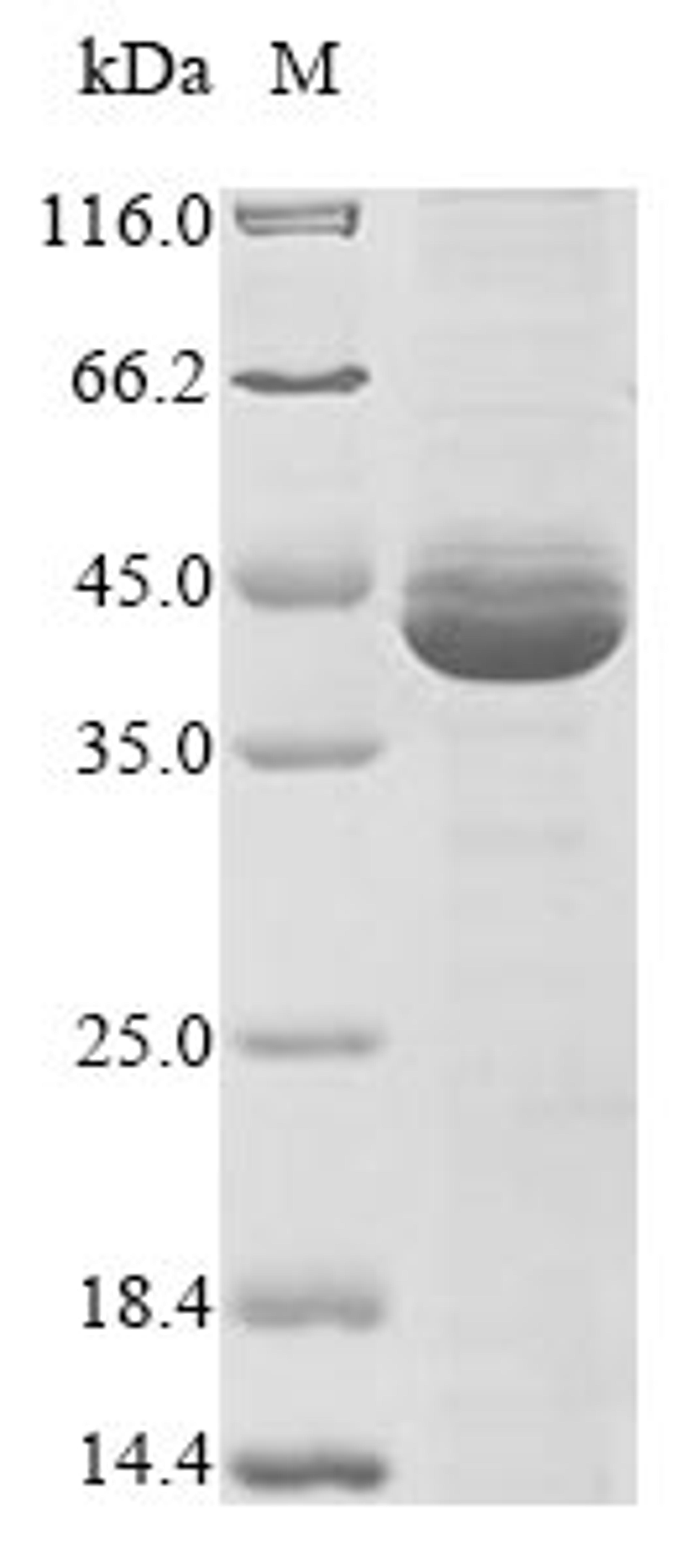 (Tris-Glycine gel) Discontinuous SDS-PAGE (reduced) with 5% enrichment gel and 15% separation gel.