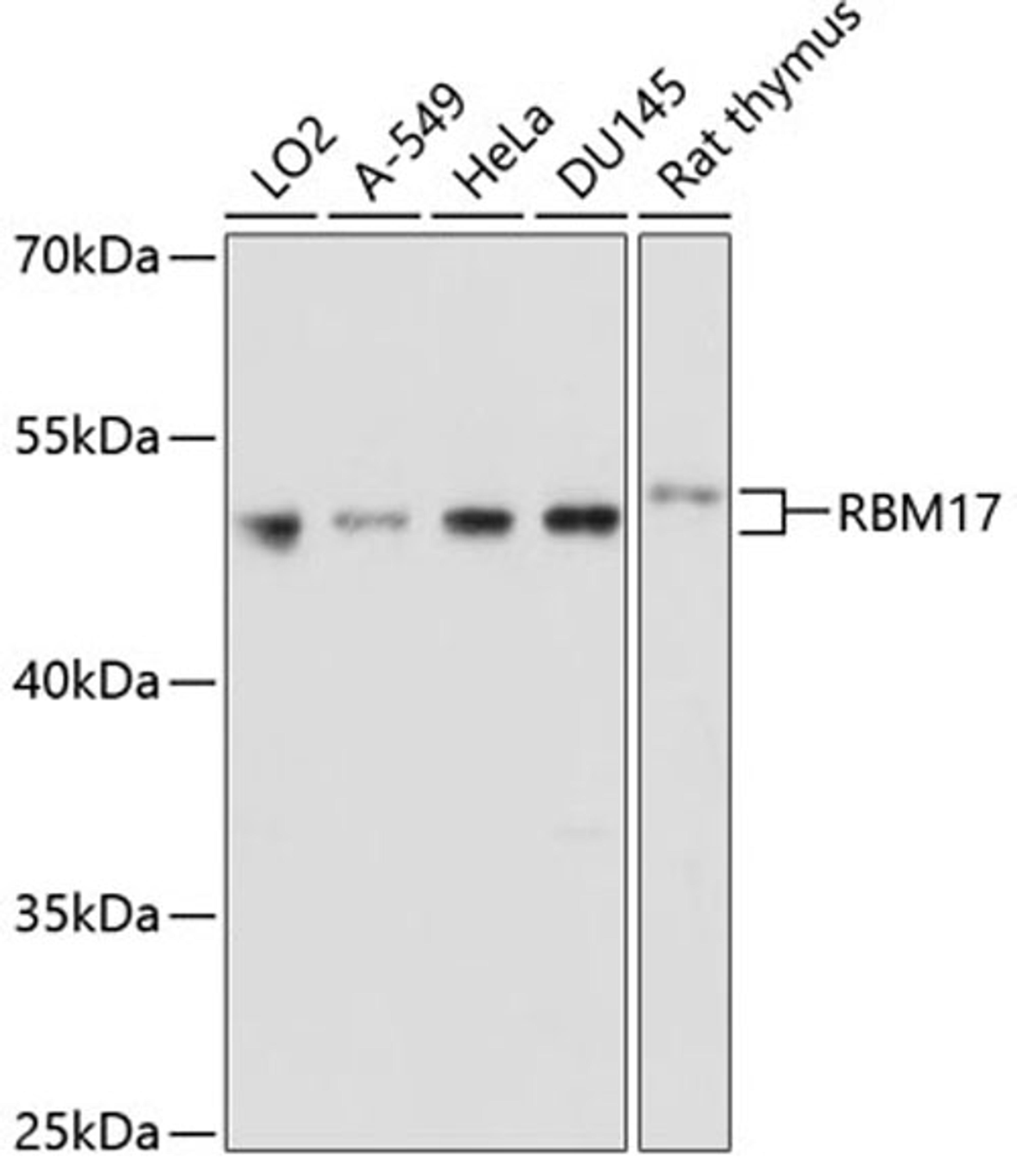 Western blot - RBM17 antibody (A3240)