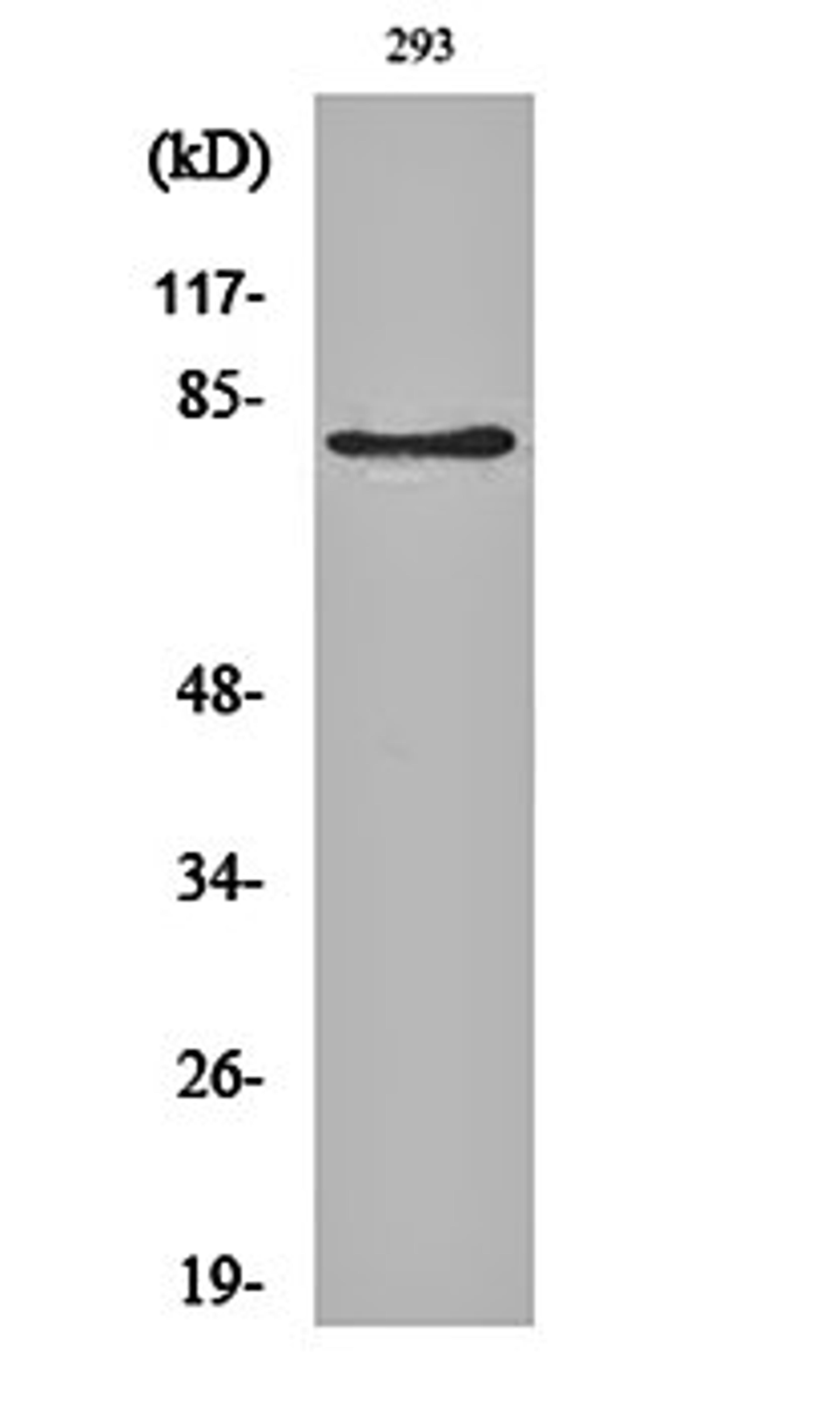 Western blot analysis of 293 cell lysates using Adducin beta antibody