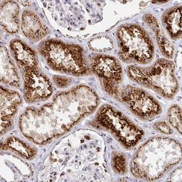 Immunohistochemistry: TM9SF1 Antibody [NBP2-32445] - Staining of human kidney shows strong cytoplasmic positivity in cells in tubules.