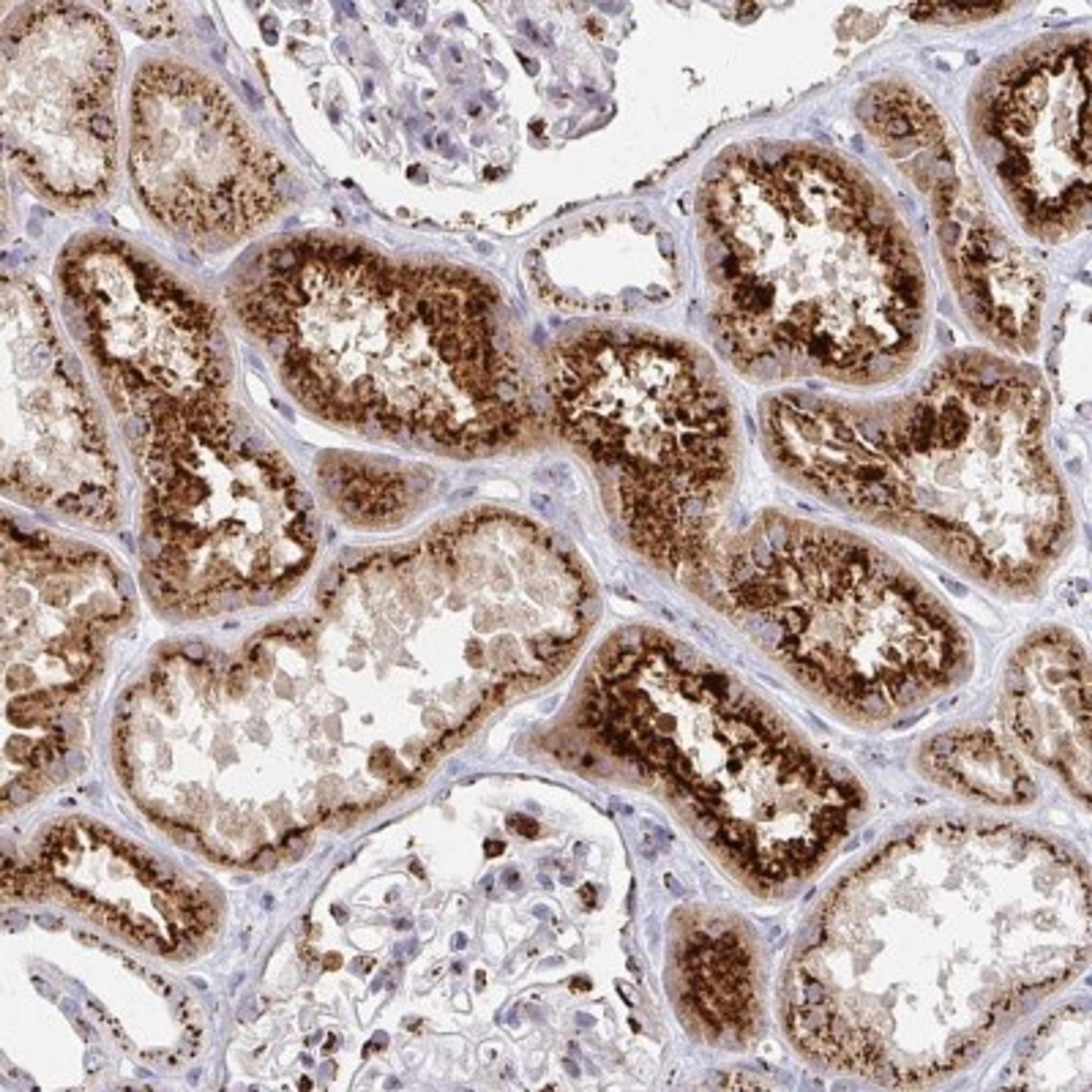 Immunohistochemistry: TM9SF1 Antibody [NBP2-32445] - Staining of human kidney shows strong cytoplasmic positivity in cells in tubules.