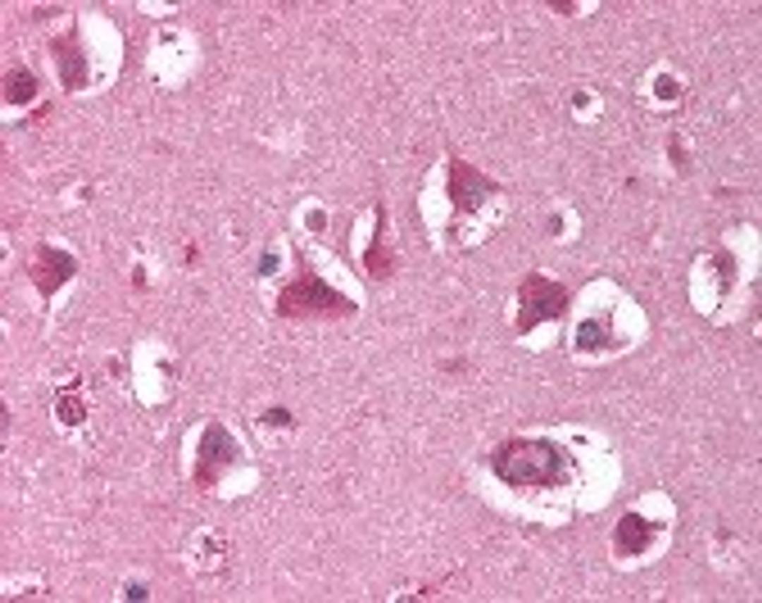 Immunohistochemistry staining of XRCC5 in brain cortex tissue using XRCC5 monoclonal Antibody.