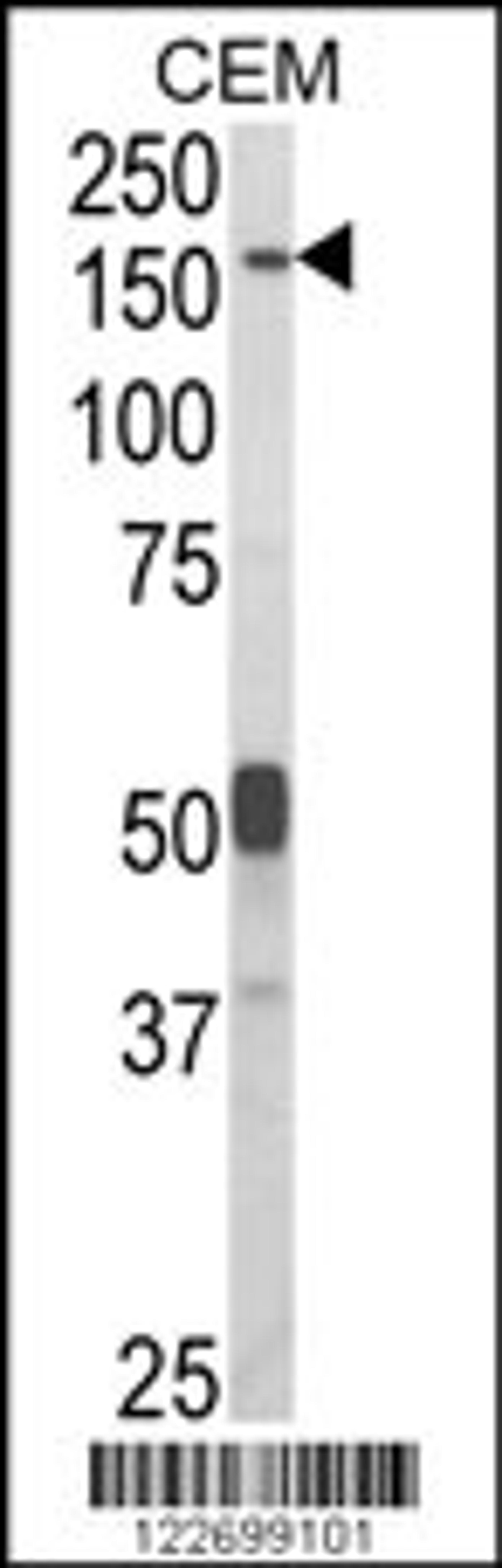 Western blot analysis of CNTNAP2 Antibody in CEM cell line lysates (35ug/lane)