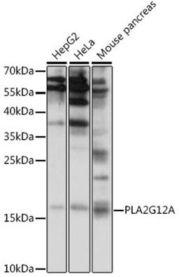 Western blot - PLA2G12A antibody (A15902)