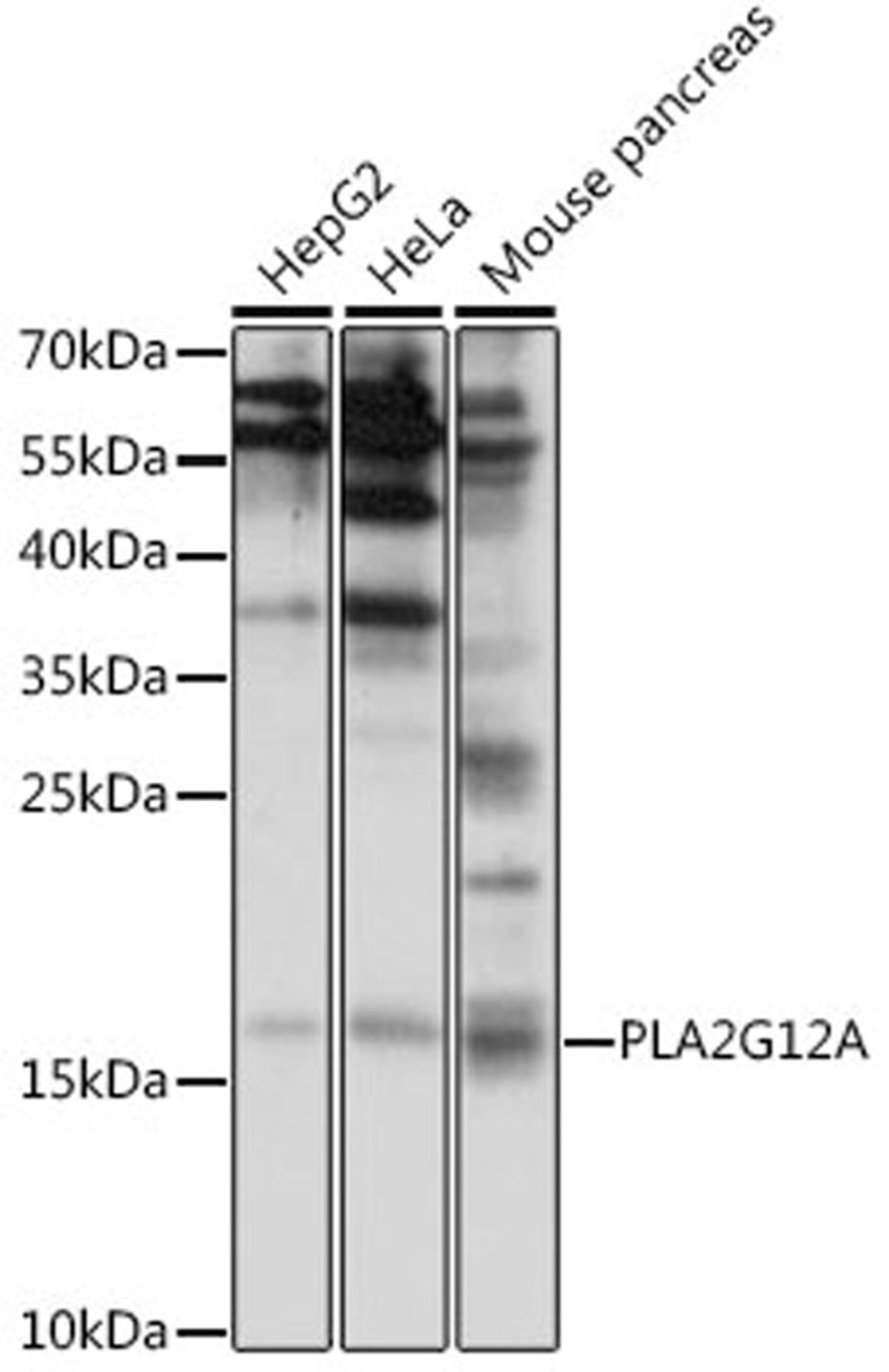 Western blot - PLA2G12A antibody (A15902)