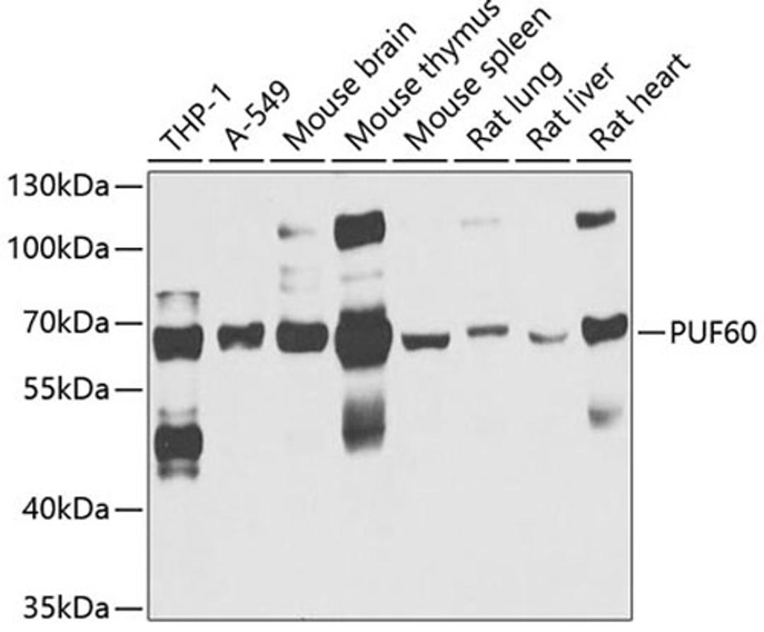 Western blot - PUF60 antibody (A6709)