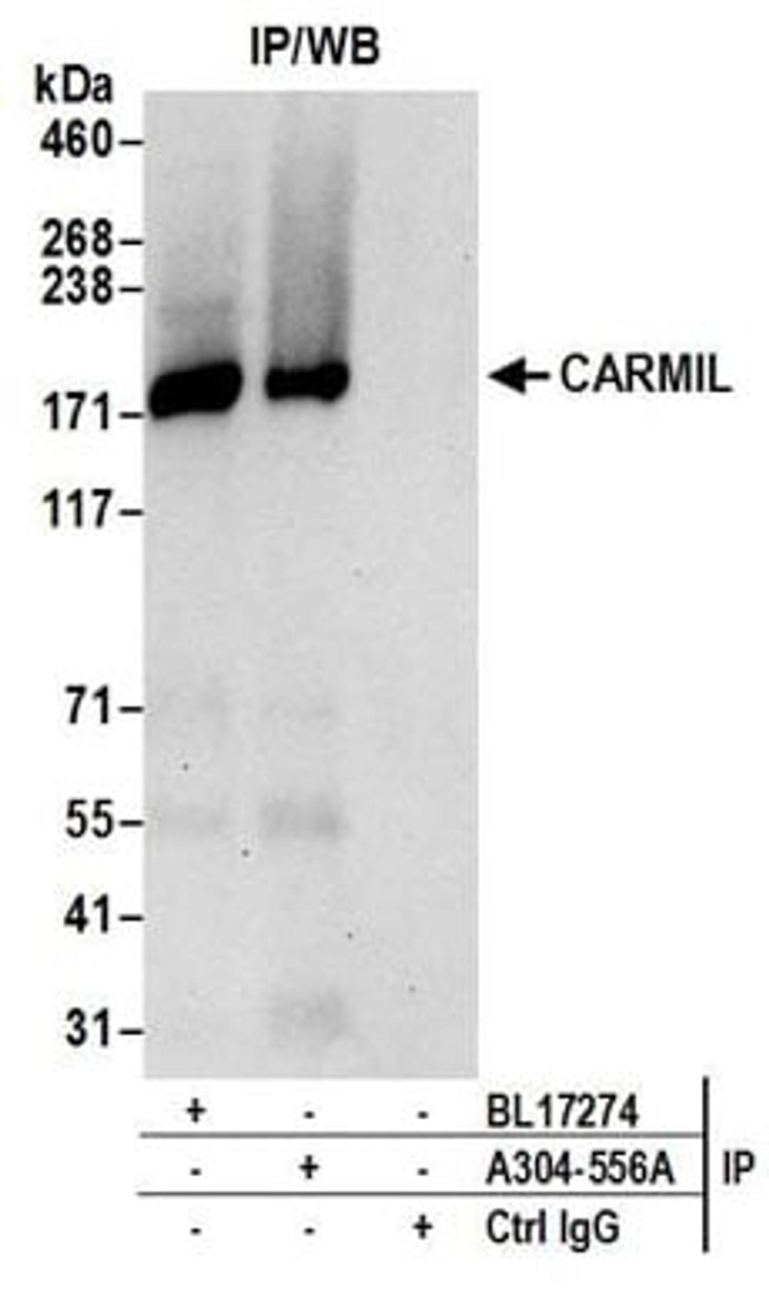 Detection of human CARMIL by western blot of immunoprecipitates.