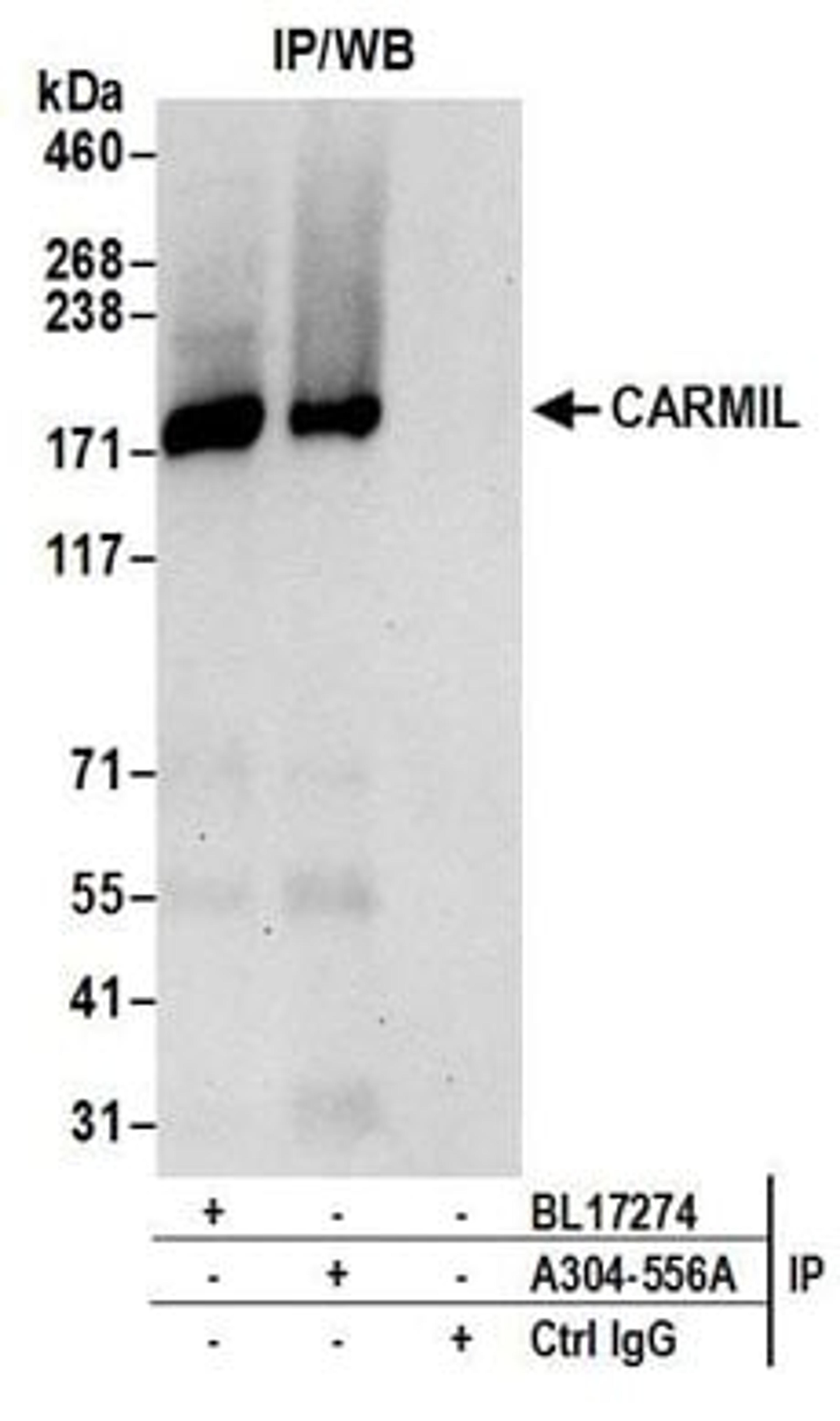 Detection of human CARMIL by western blot of immunoprecipitates.