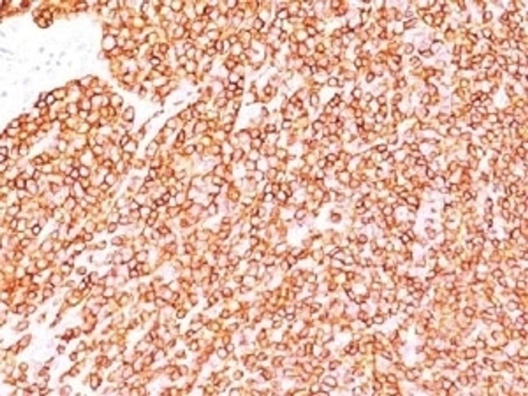 IHC testing of FFPE human tonsil with anti-CD45 antibody