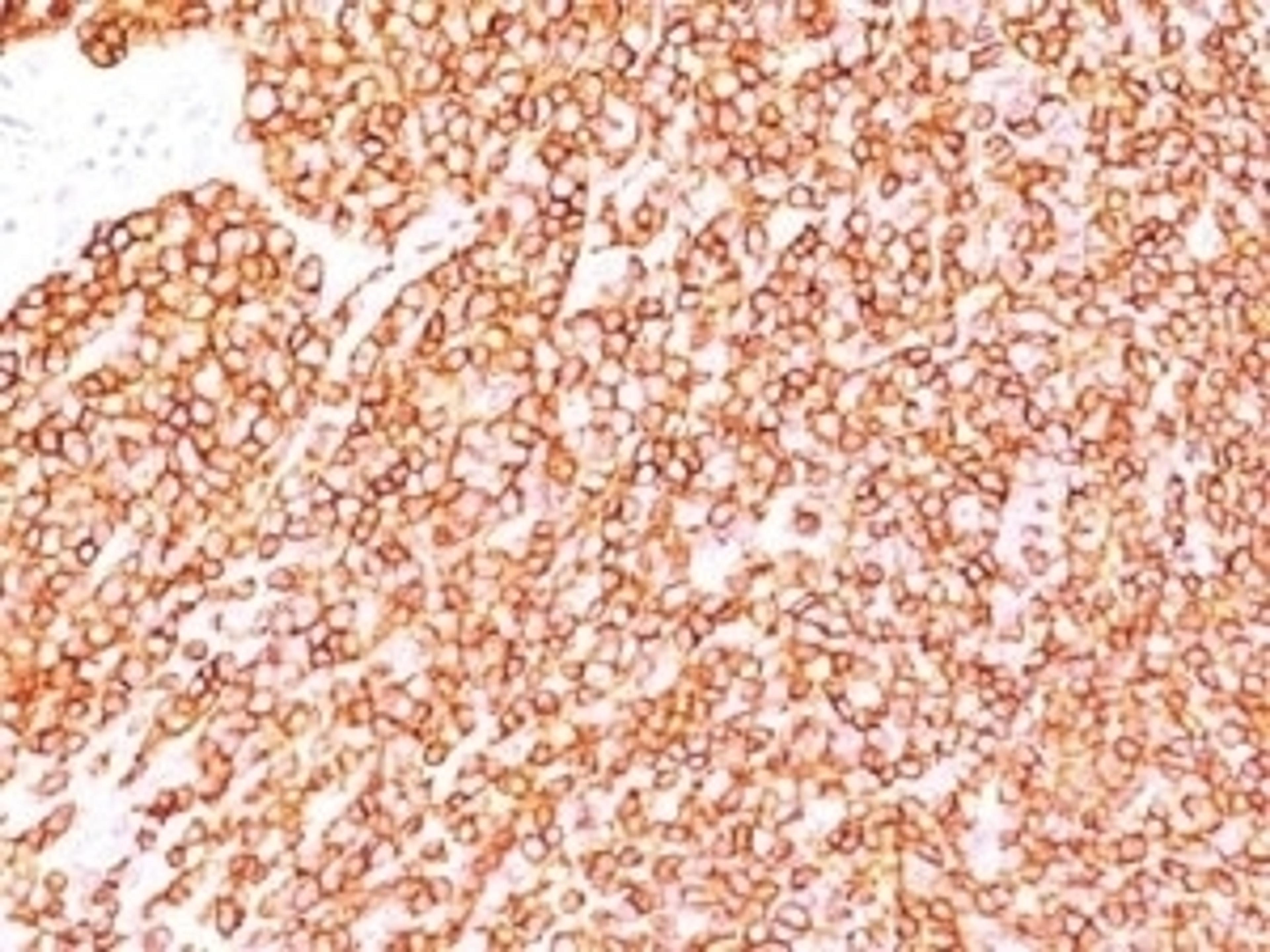 IHC testing of FFPE human tonsil with anti-CD45 antibody