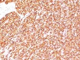 IHC testing of FFPE human tonsil with anti-CD45 antibody