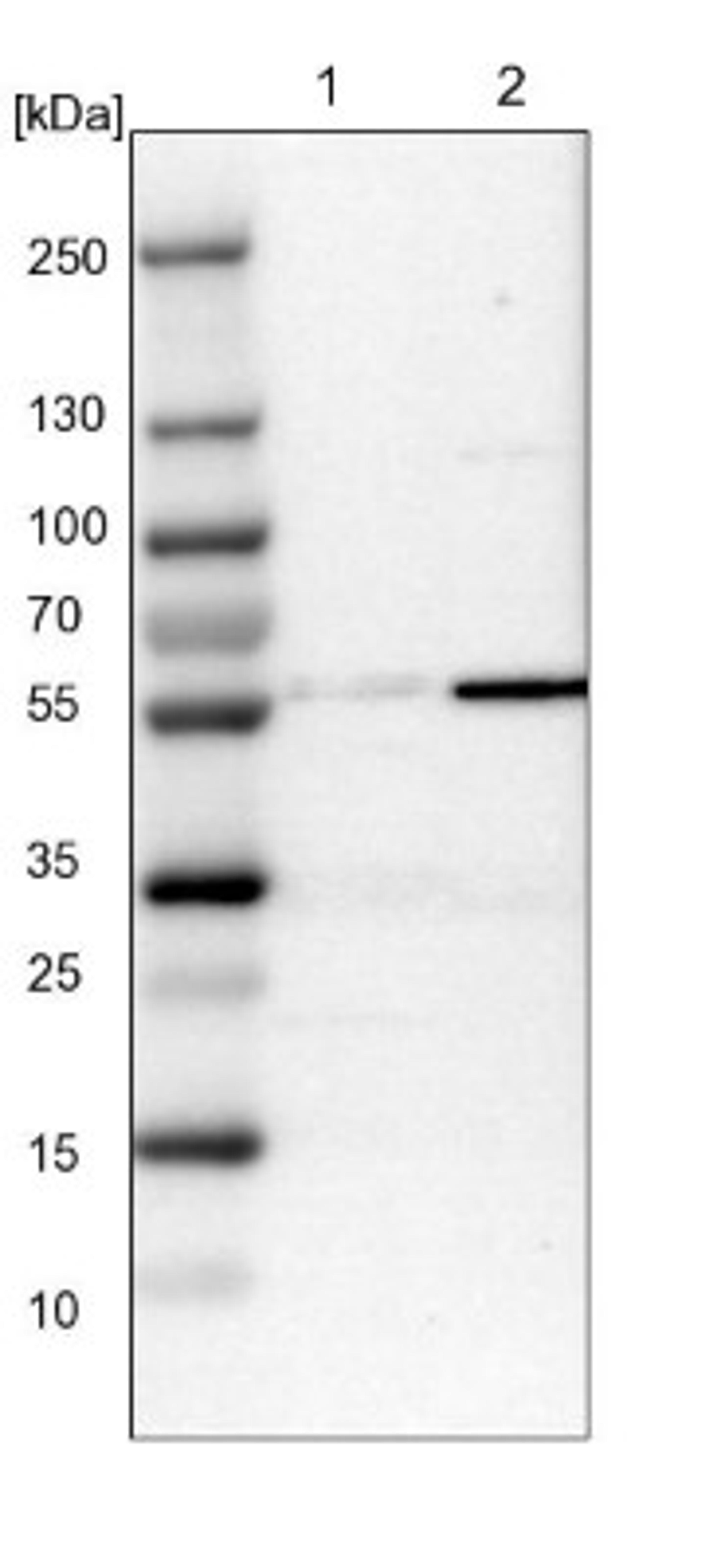 Western Blot: MFSD11 Antibody [NBP1-93984] - Lane 1: NIH-3T3 cell lysate (Mouse embryonic fibroblast cells)<br/>Lane 2: NBT-II cell lysate (Rat Wistar bladder tumour cells)