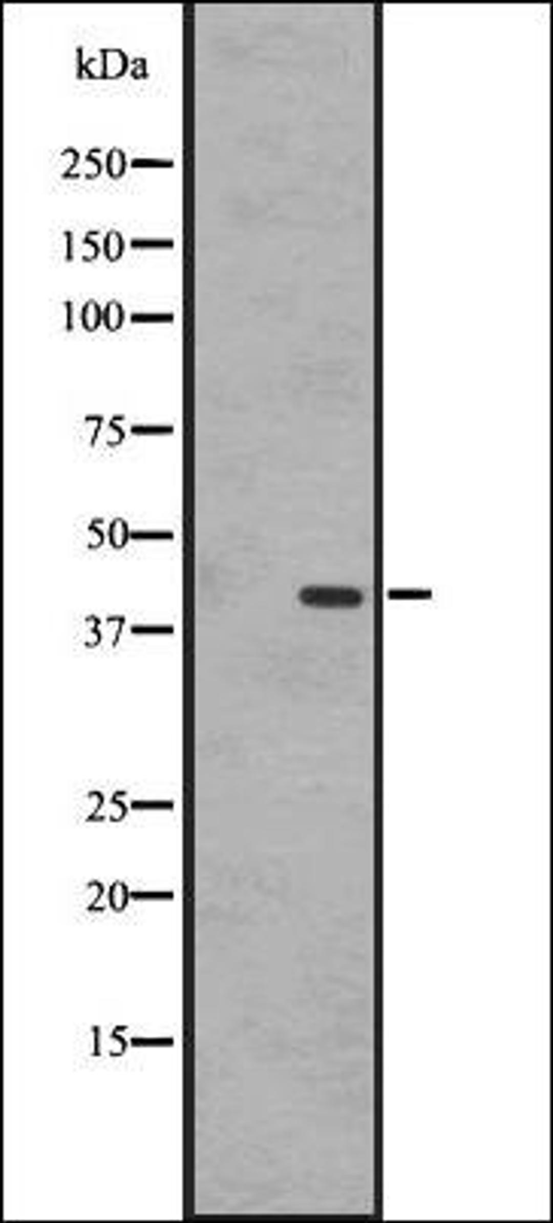 Western blot analysis of A431 whole cell lysate using EBI2 antibody