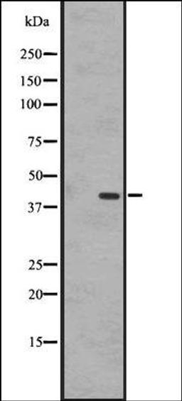 Western blot analysis of A431 whole cell lysate using EBI2 antibody