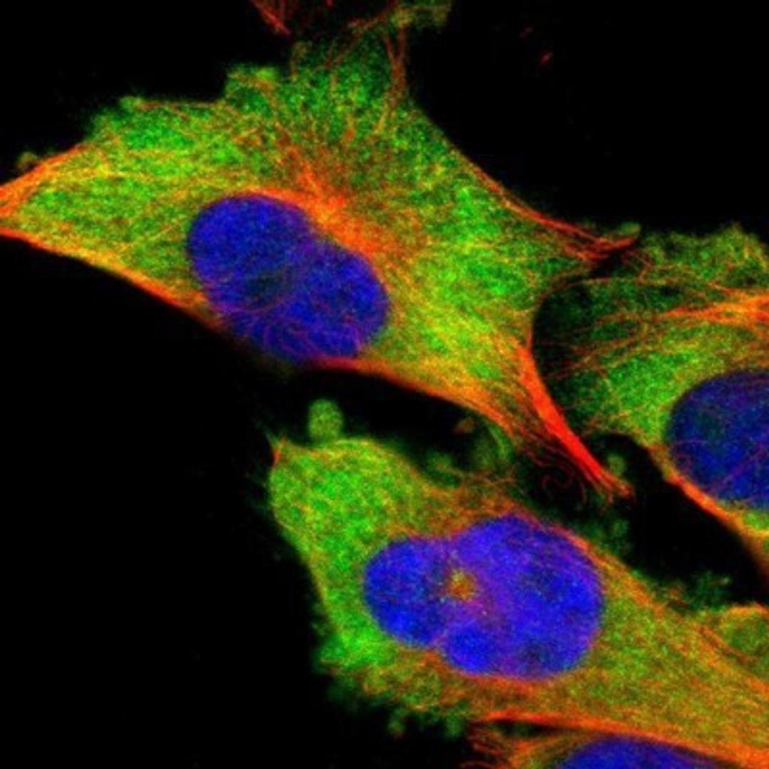 Immunocytochemistry/Immunofluorescence: DDX3 Antibody [NBP1-85291] - Staining of human cell line U-251MG shows positivity in cytoplasm.