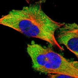 Immunocytochemistry/Immunofluorescence: DDX3 Antibody [NBP1-85291] - Staining of human cell line U-251MG shows positivity in cytoplasm.