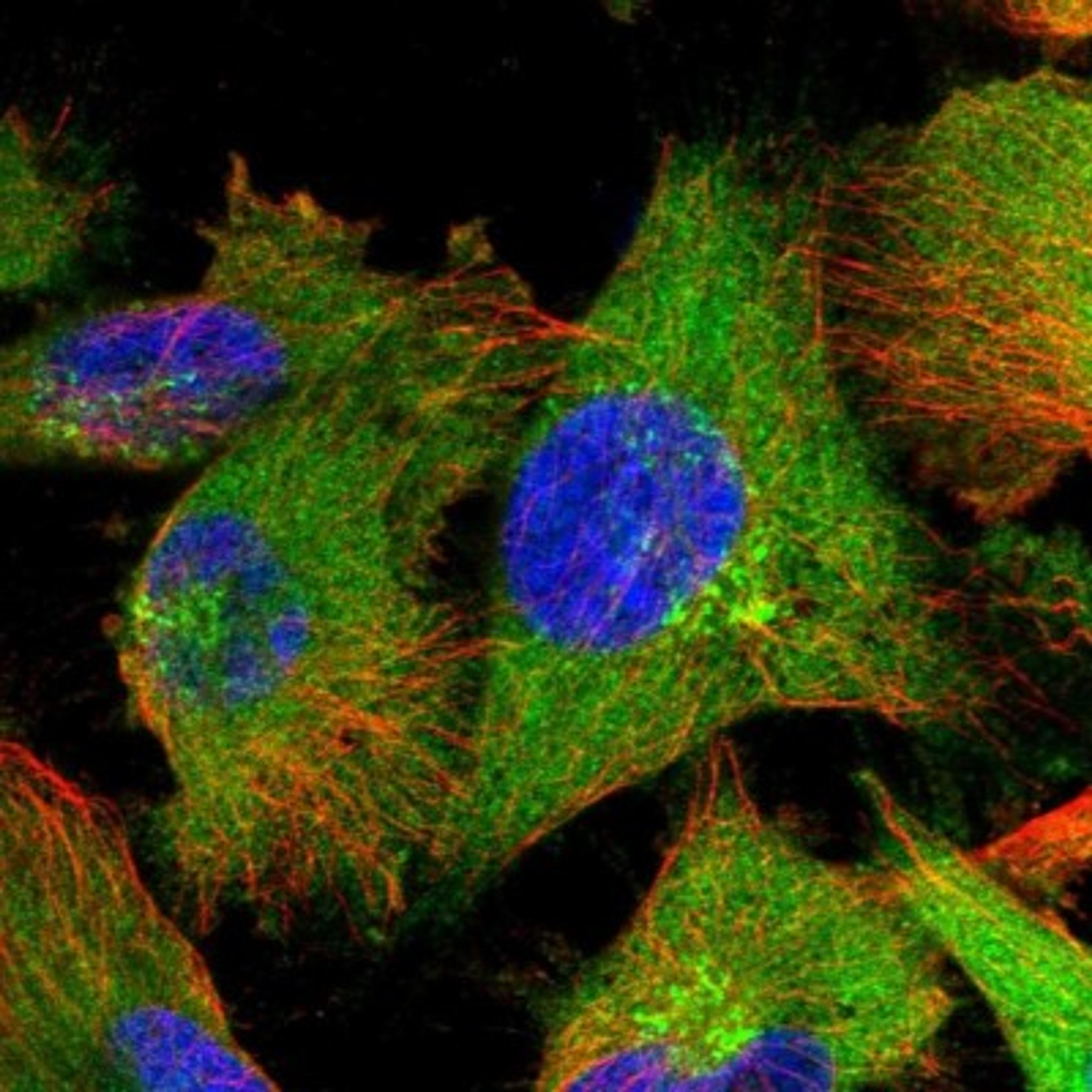 Immunofluorescence: ZCCHV Antibody [NBP1-92607] - Immunofluorescent staining of human cell line U-251 MG shows positivity in plasma membrane, cytoplasm & golgi apparatus.