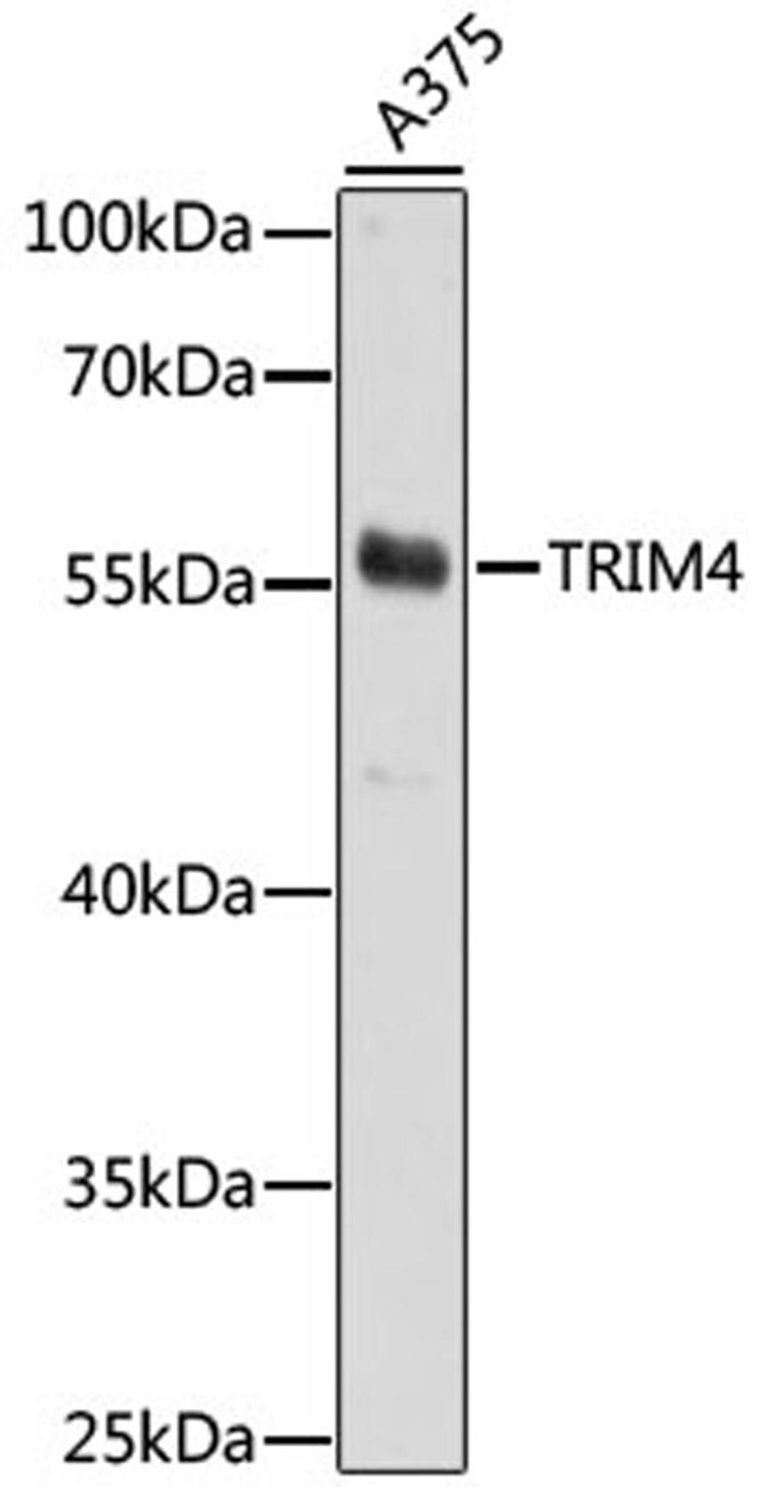 Western blot - TRIM4 antibody (A15922)