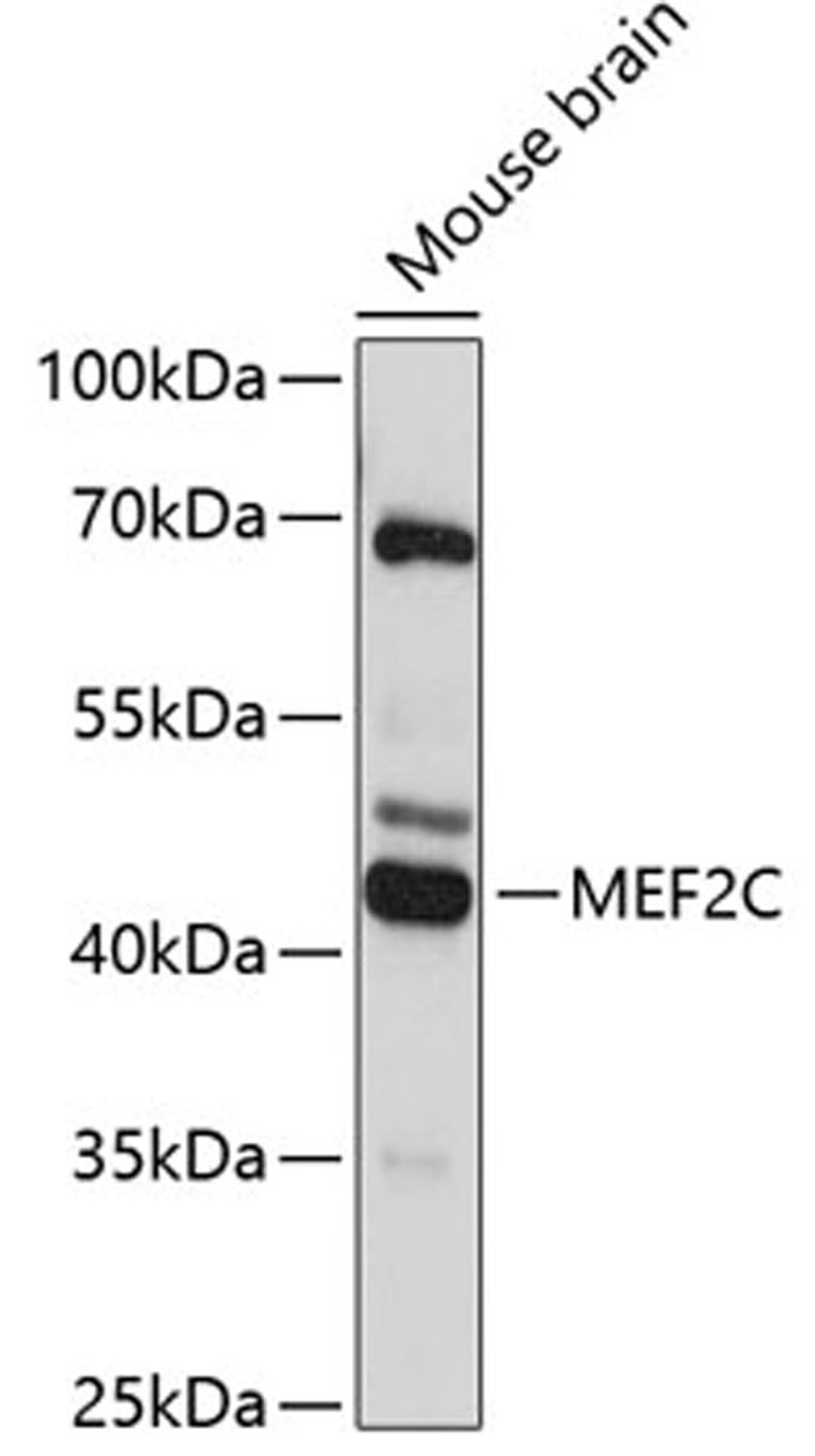 Western blot - MEF2C antibody (A12385)