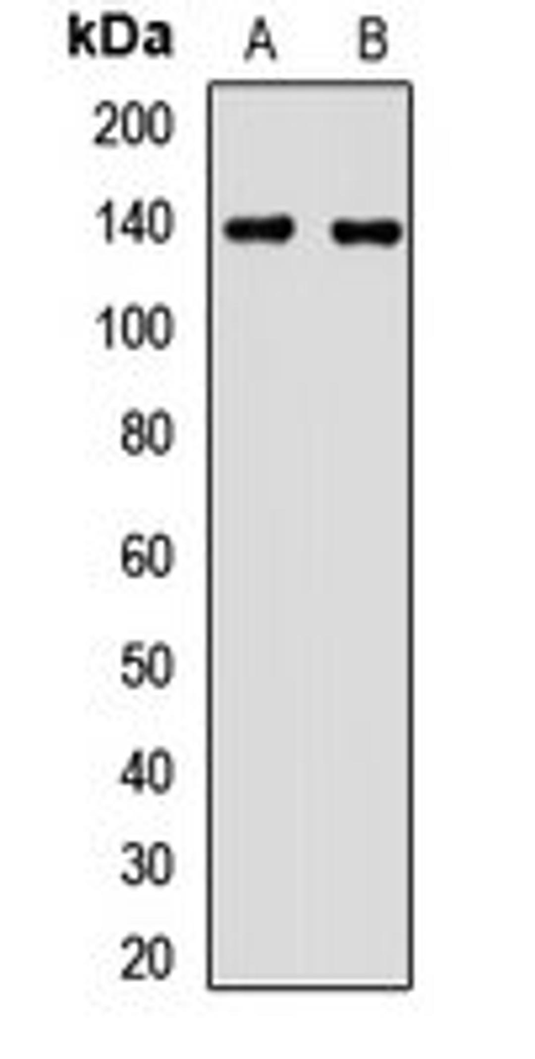 Western blot analysis of Hela (Lane1), Jurkat (Lane2) whole cell lysates using MTMR3 antibody