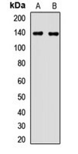 Western blot analysis of Hela (Lane1), Jurkat (Lane2) whole cell lysates using MTMR3 antibody