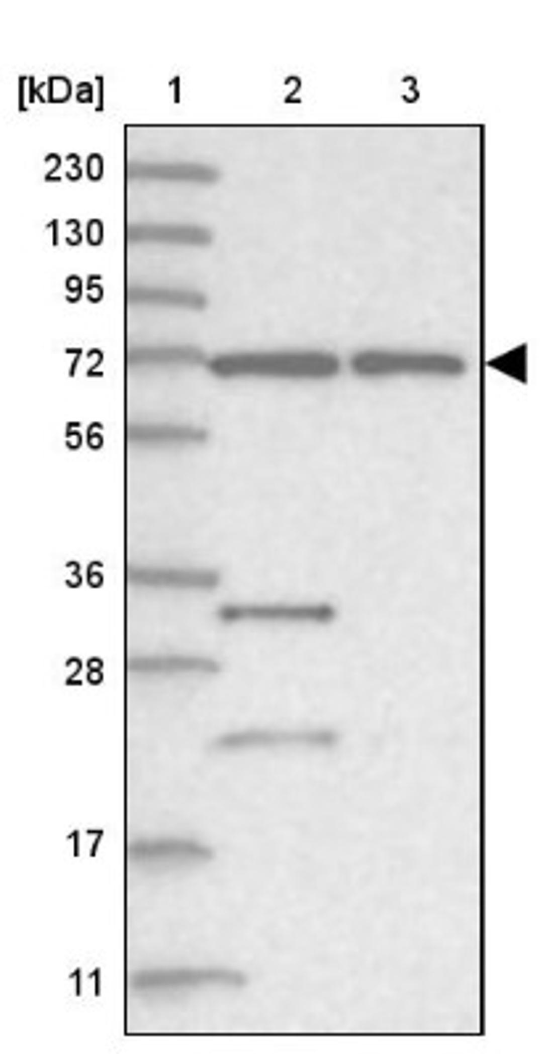 Western Blot: ZNF674 Antibody [NBP1-93452] - Lane 1: Marker [kDa] 230, 130, 95, 72, 56, 36, 28, 17, 11<br/>Lane 2: Human cell line RT-4<br/>Lane 3: Human cell line U-251MG sp