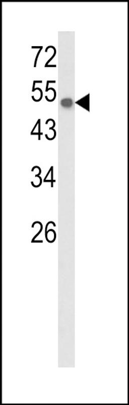 Western blot analysis of CYP8A1 Antibody in CEM cell line lysates (35ug/lane)