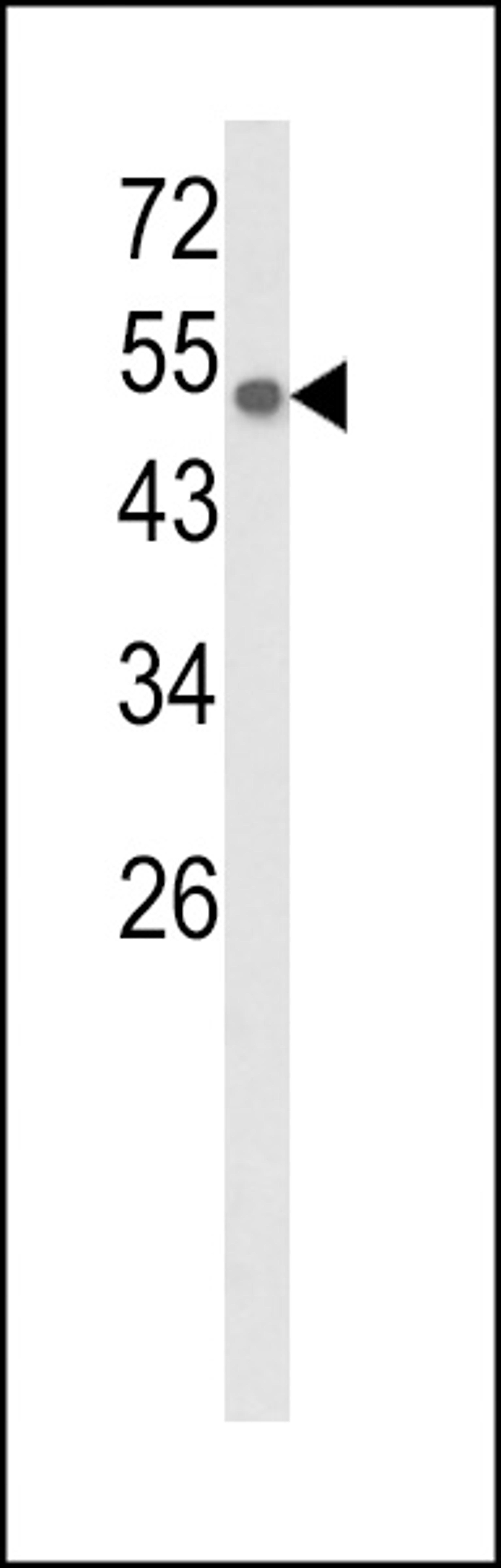 Western blot analysis of CYP8A1 Antibody in CEM cell line lysates (35ug/lane)